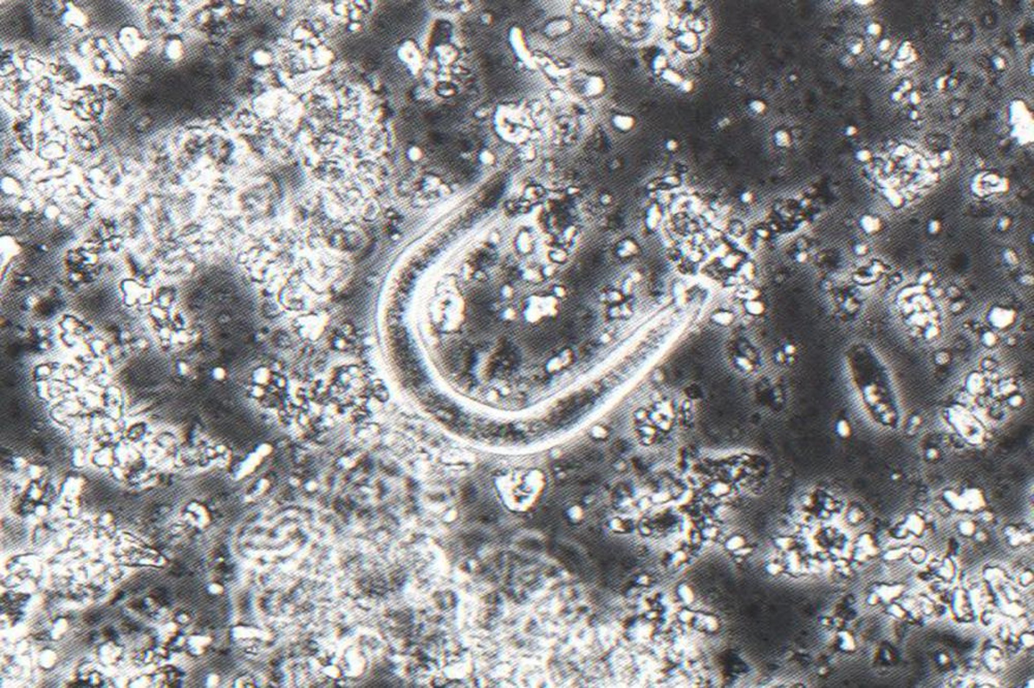 Huevos de anquilostoma (<i >Kalicephalus</i> spp), pitón de cola corta
