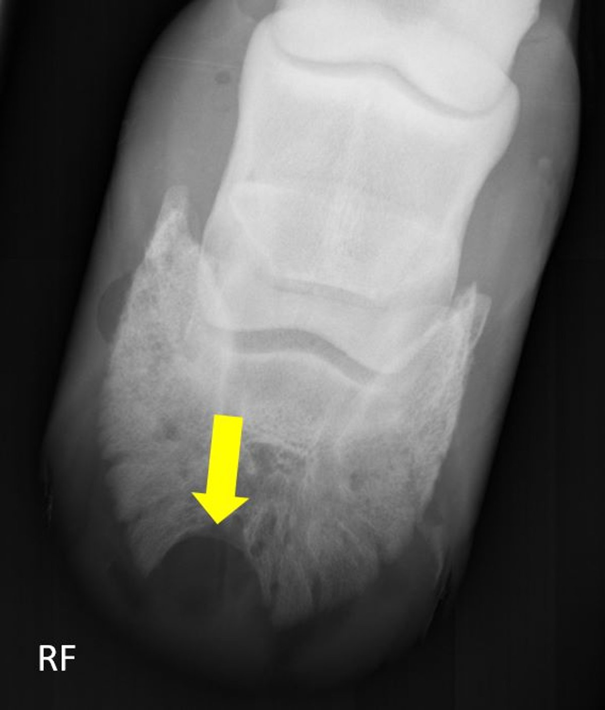 Keratoma, radiograph, horse