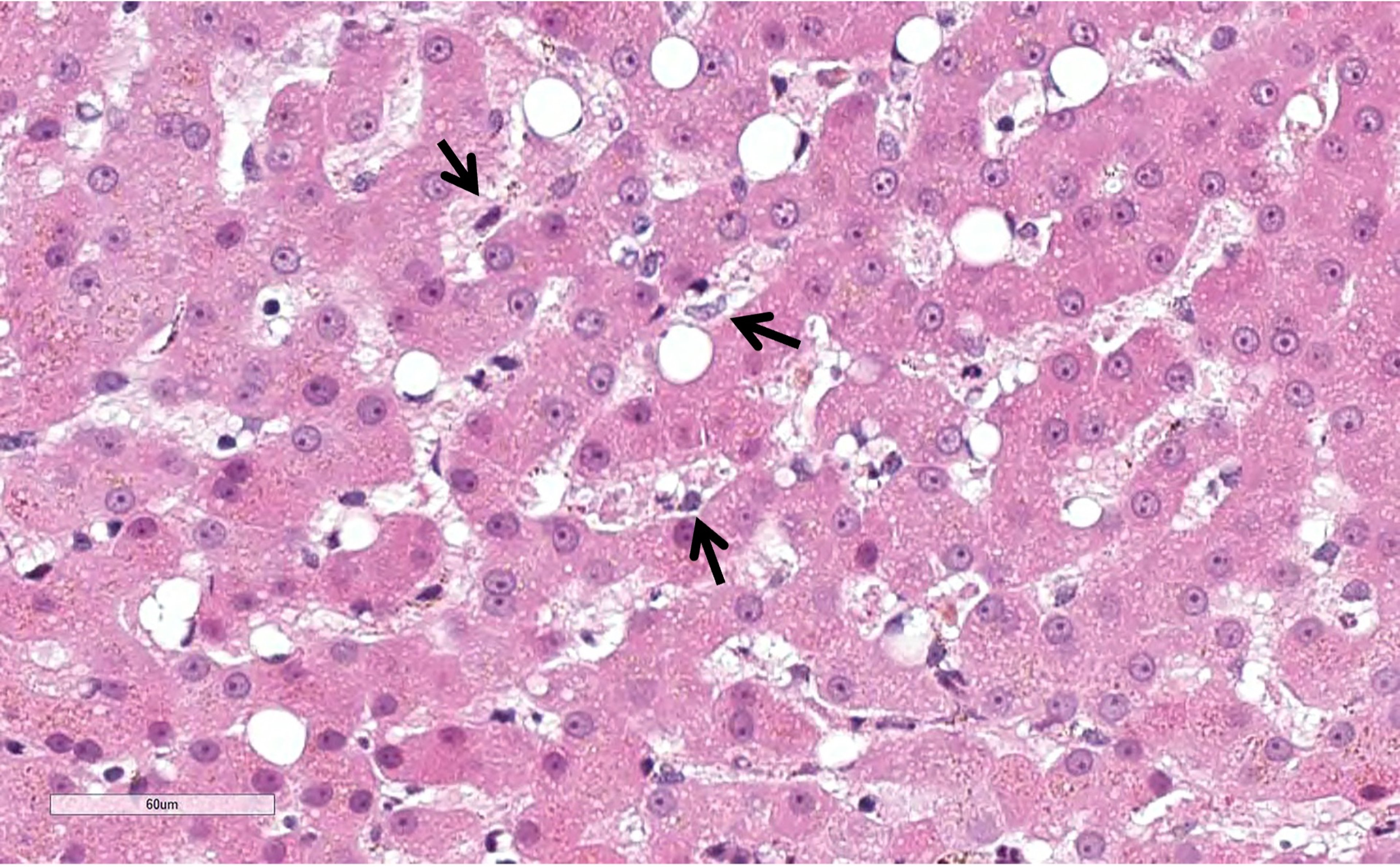 Kupffer cell activation, photomicrograph, dog