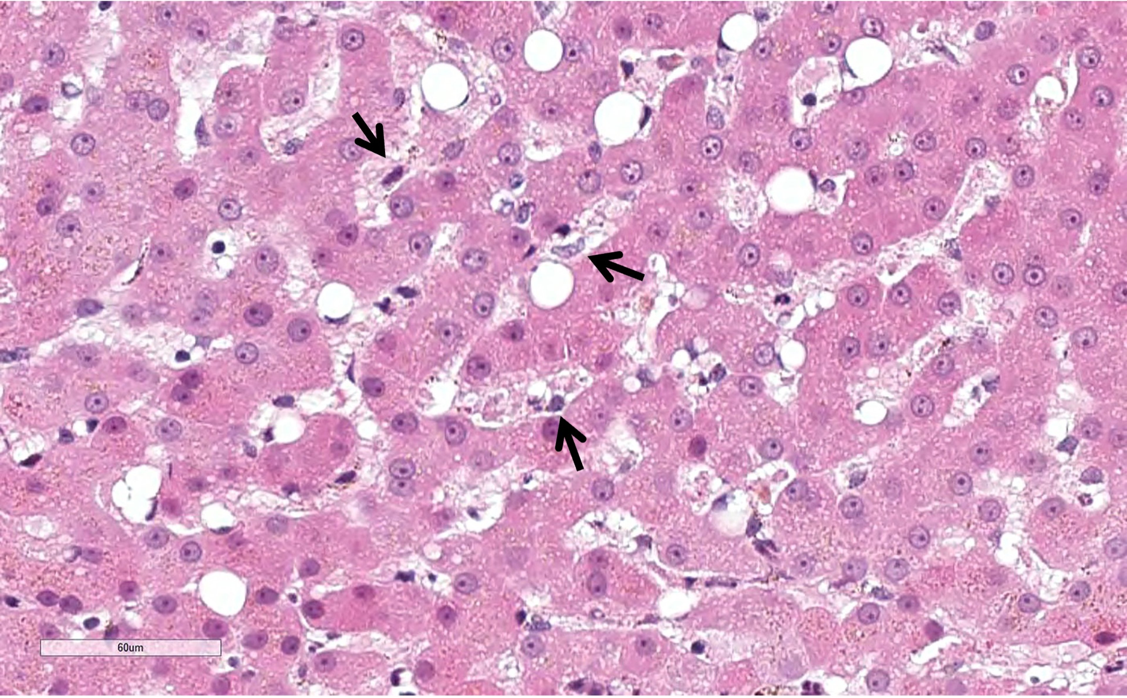 Activación de las células de Kupffer, microfotografía, perro