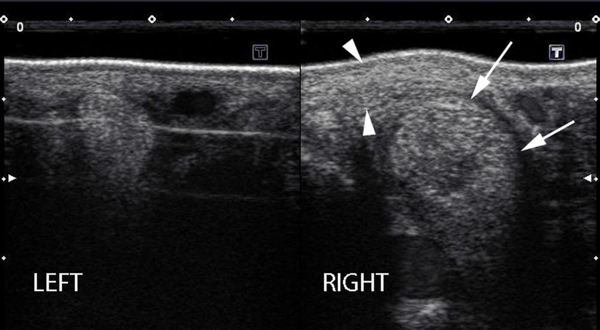 Left and right medial suspensory branches, ultrasound, horse