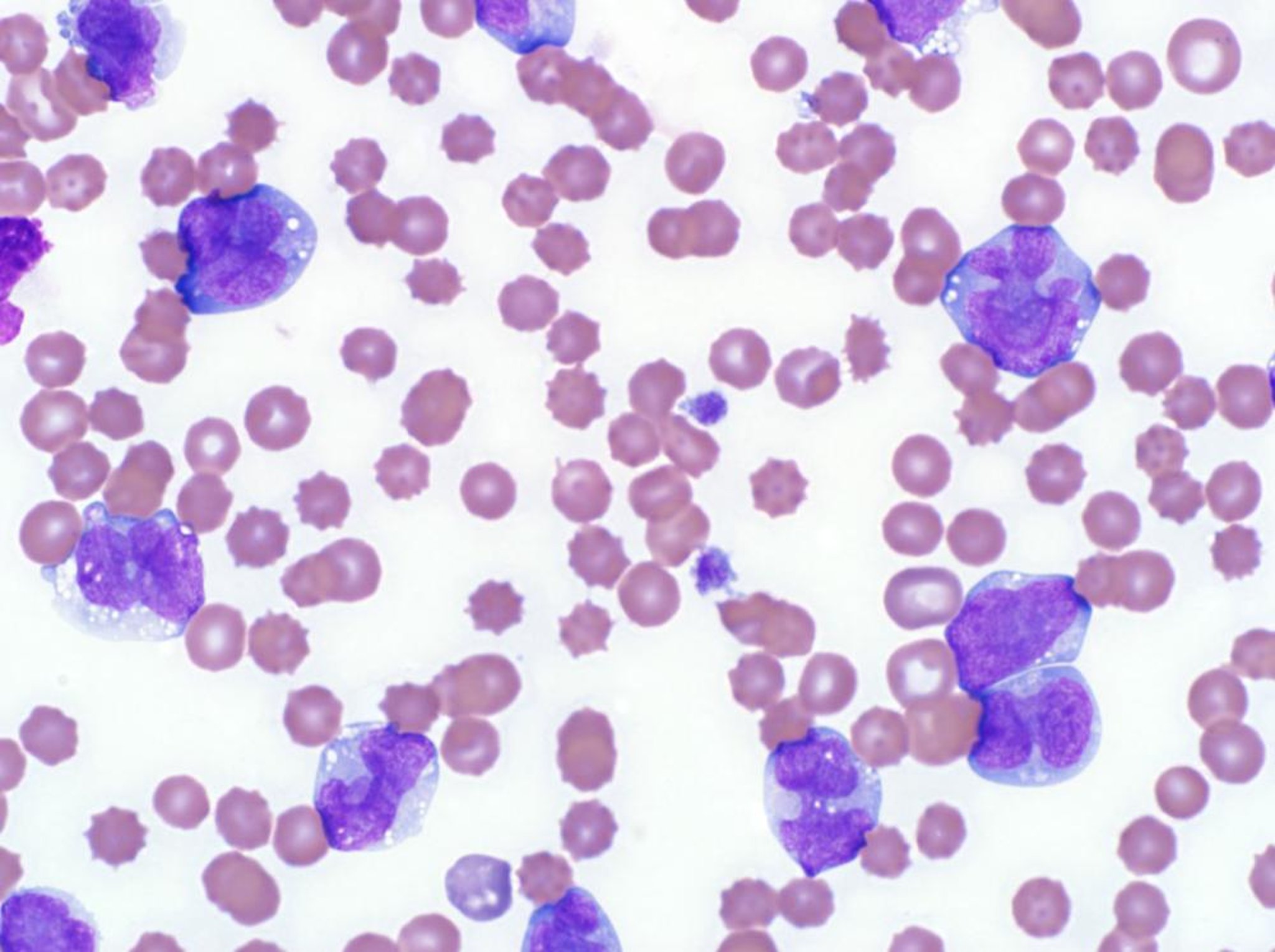 Leukemia, blood smear, dog