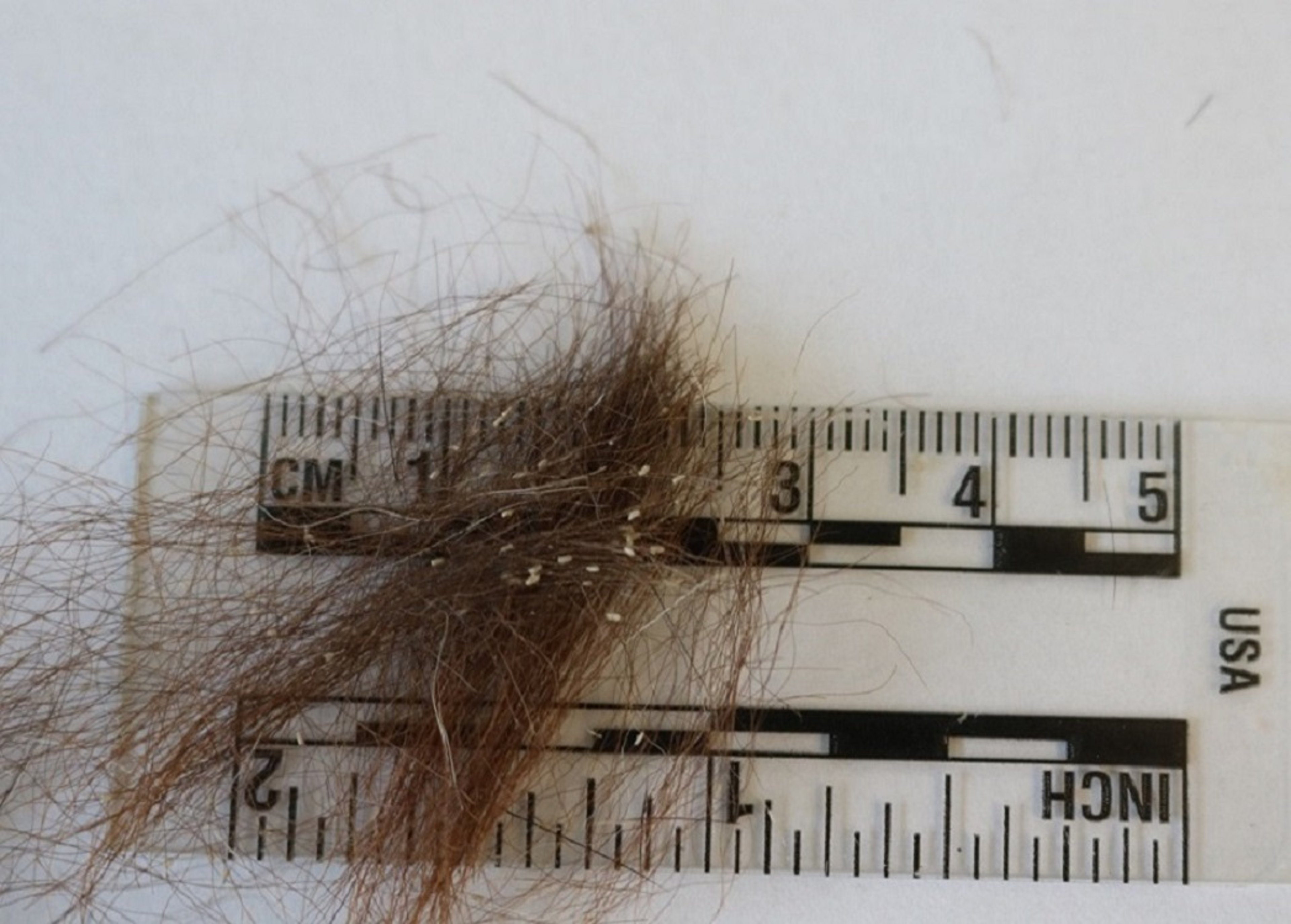 Lice eggs (nits)