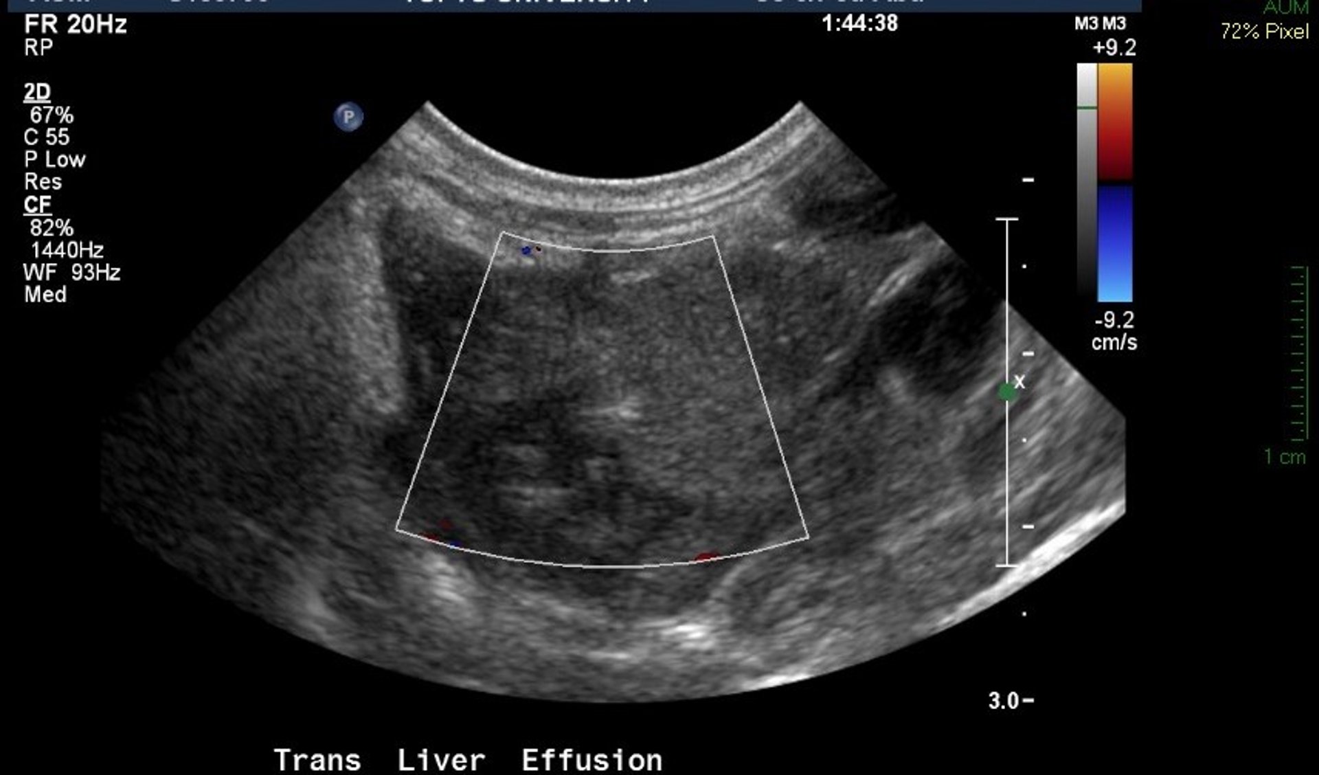 Liver torsion, rabbit