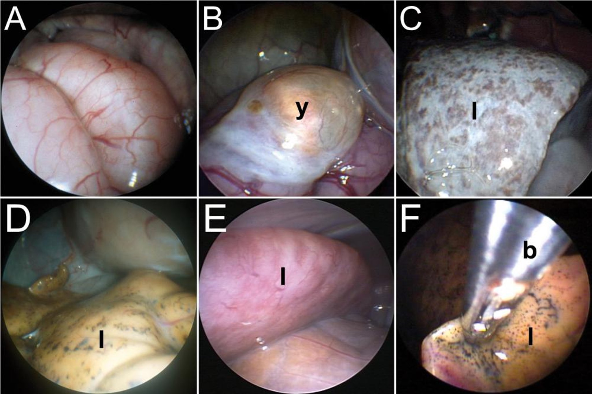 Endoscopic pathology and liver biopsy, various reptiles