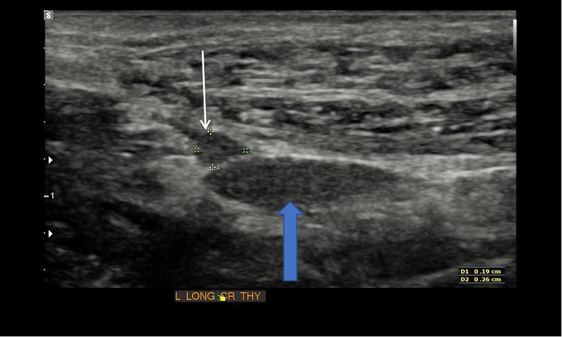 Thyroid, longitudinal ultrasonography, dog