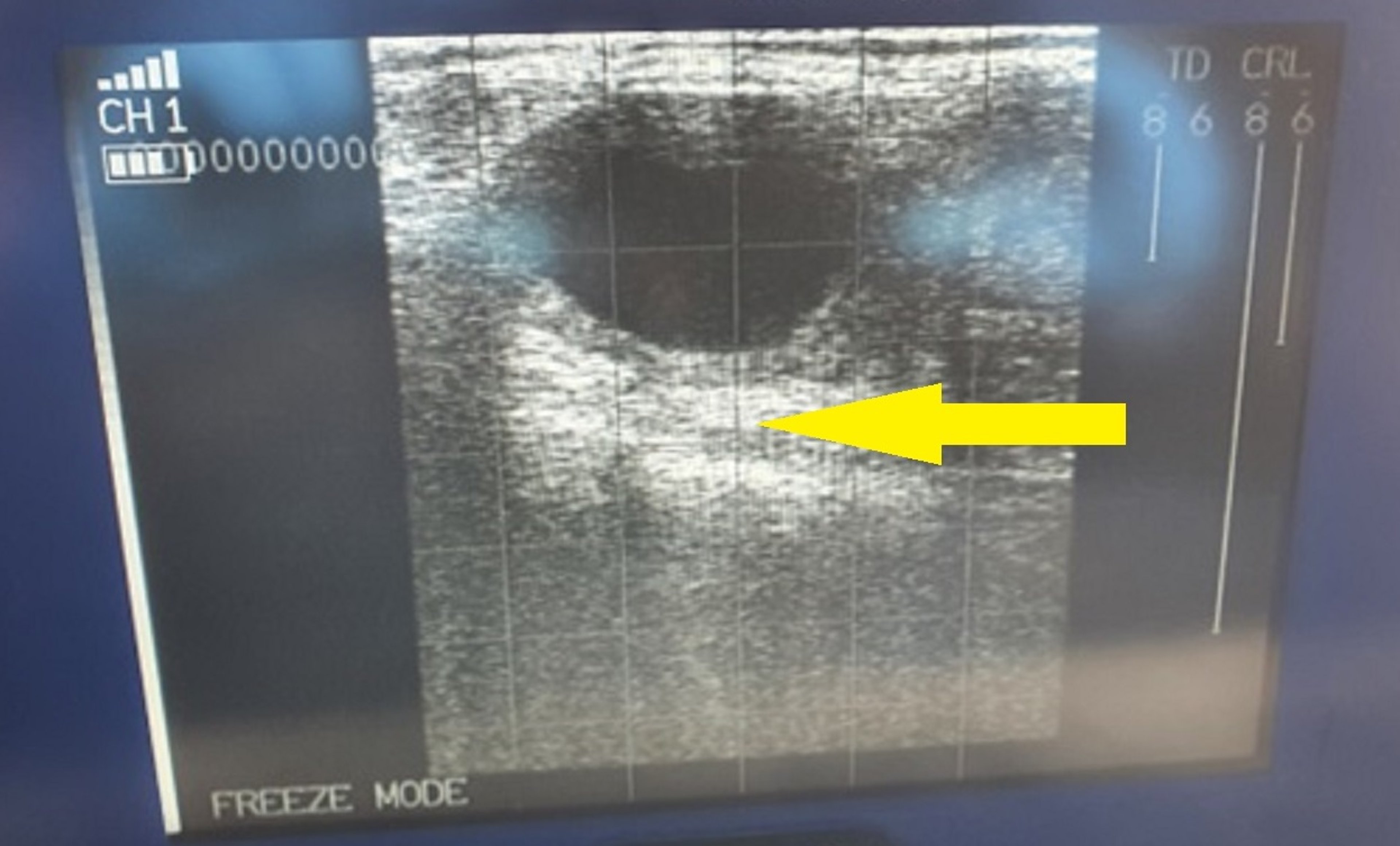 Luteal cyst, ultrasonographic image, cow