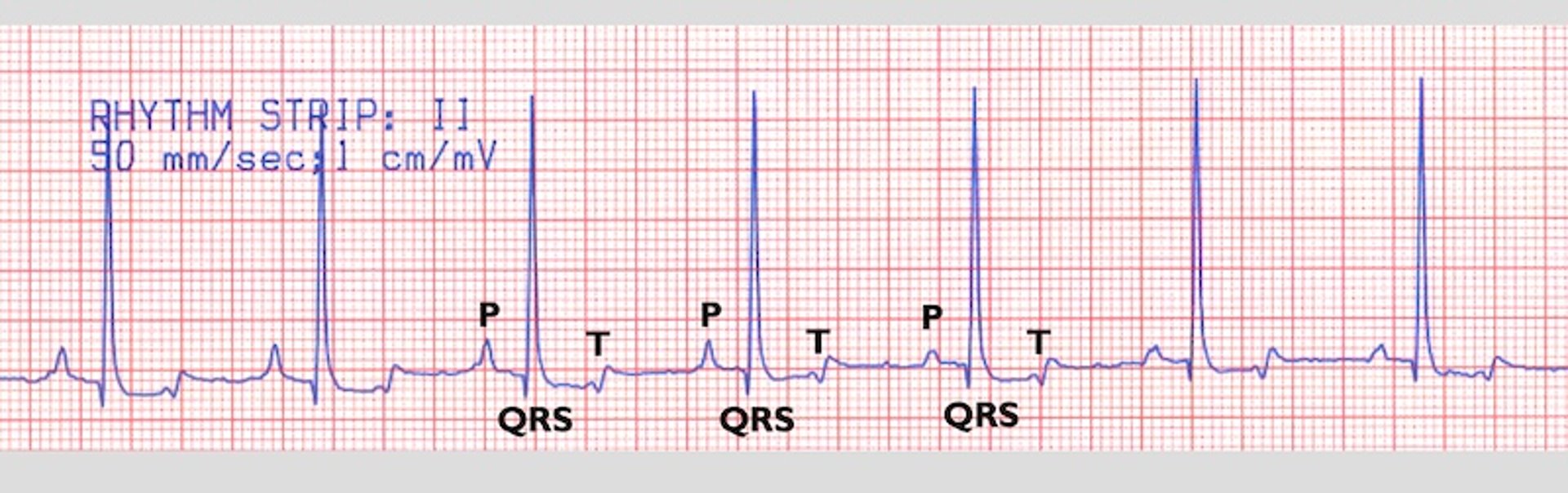 Normal sinus rhythm, labeled ECG, dog