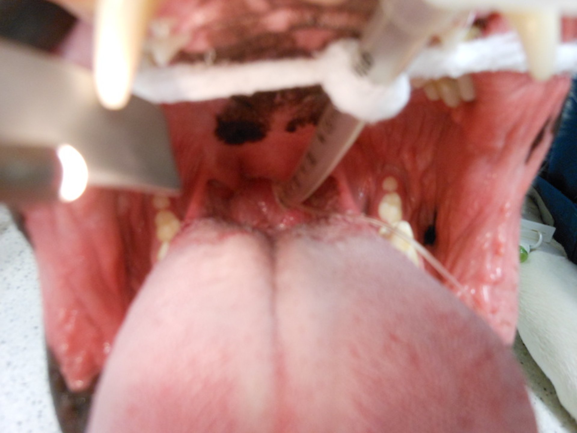 Laryngeal edema and intubation, dog