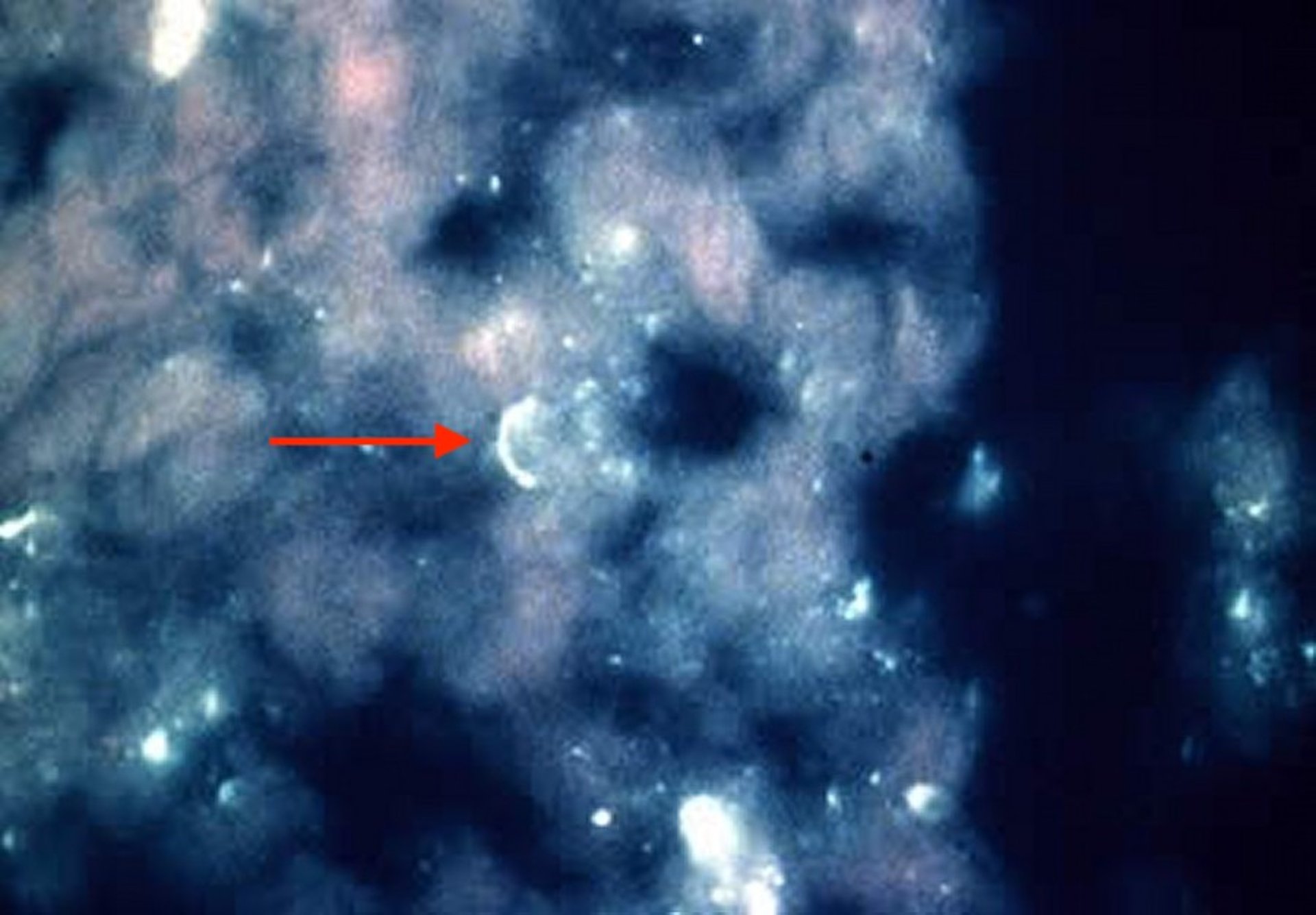 <i >Leptospira borgpetersenii</i> serovar Hardjo, bovine abortion, photomicrograph