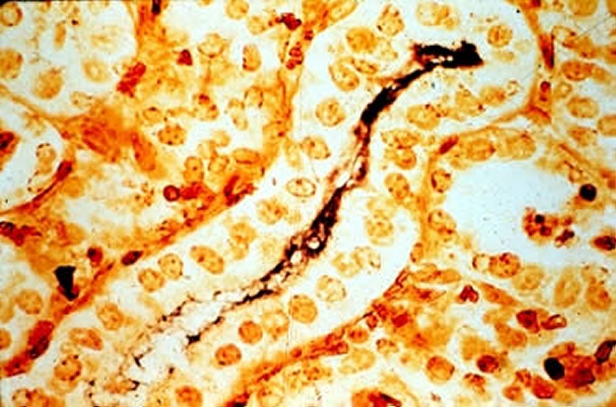 <i >Leptospira interrogans</i>, riñón, cerdo