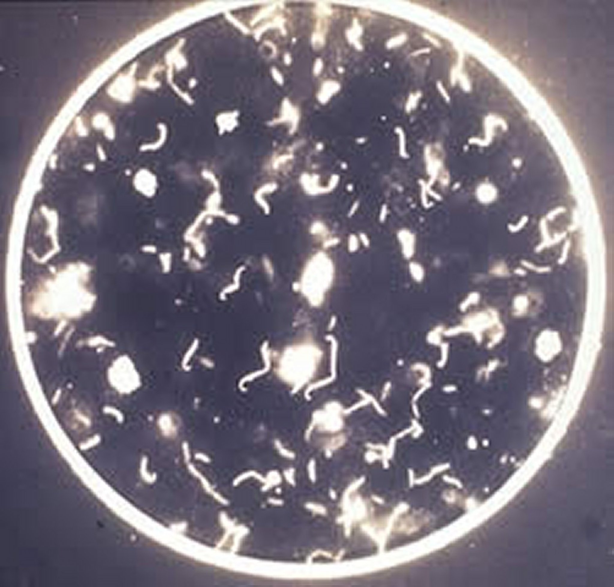 <i >Leptospira interrogans</i>, aglutinación microscópica