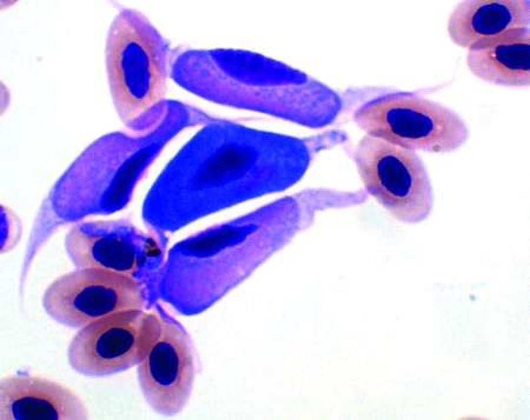 <i >Leucocytozoon</i>, microfotografía, sangre, halcón de cola roja