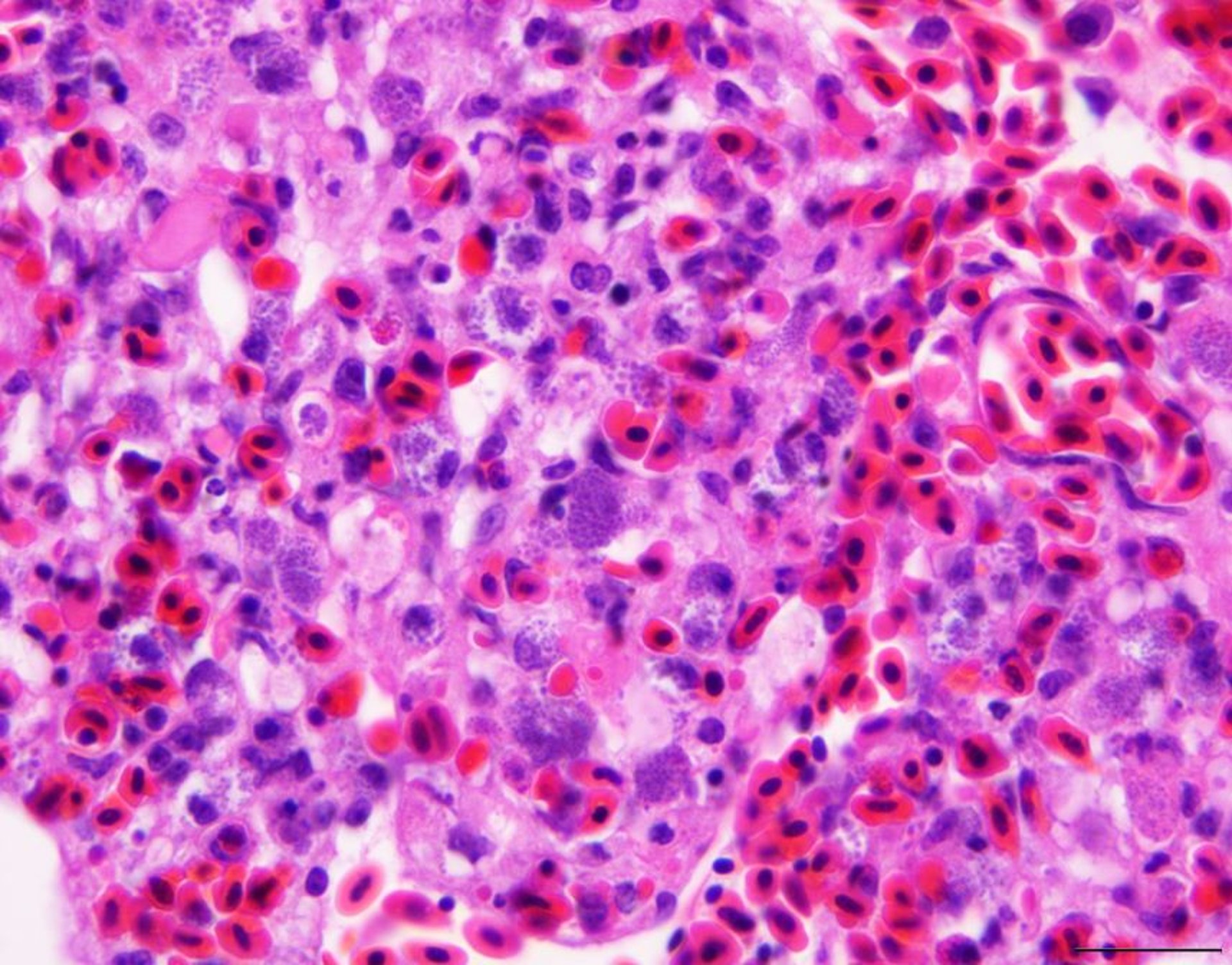 <i >Leucocytozoon</i>, microfotografía, pulmón, pato criollo