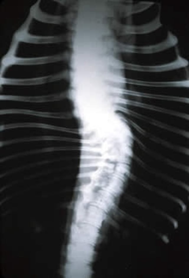 Escoliosis, radiografía, caballo