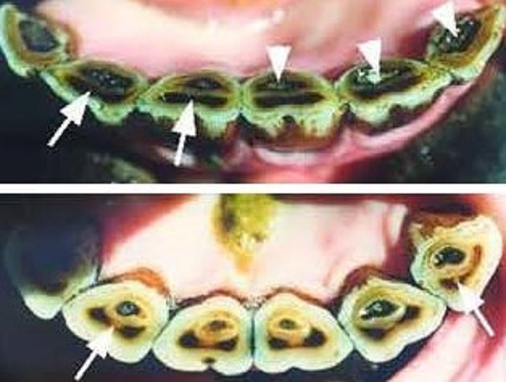 Incisivos inferiores, yegua