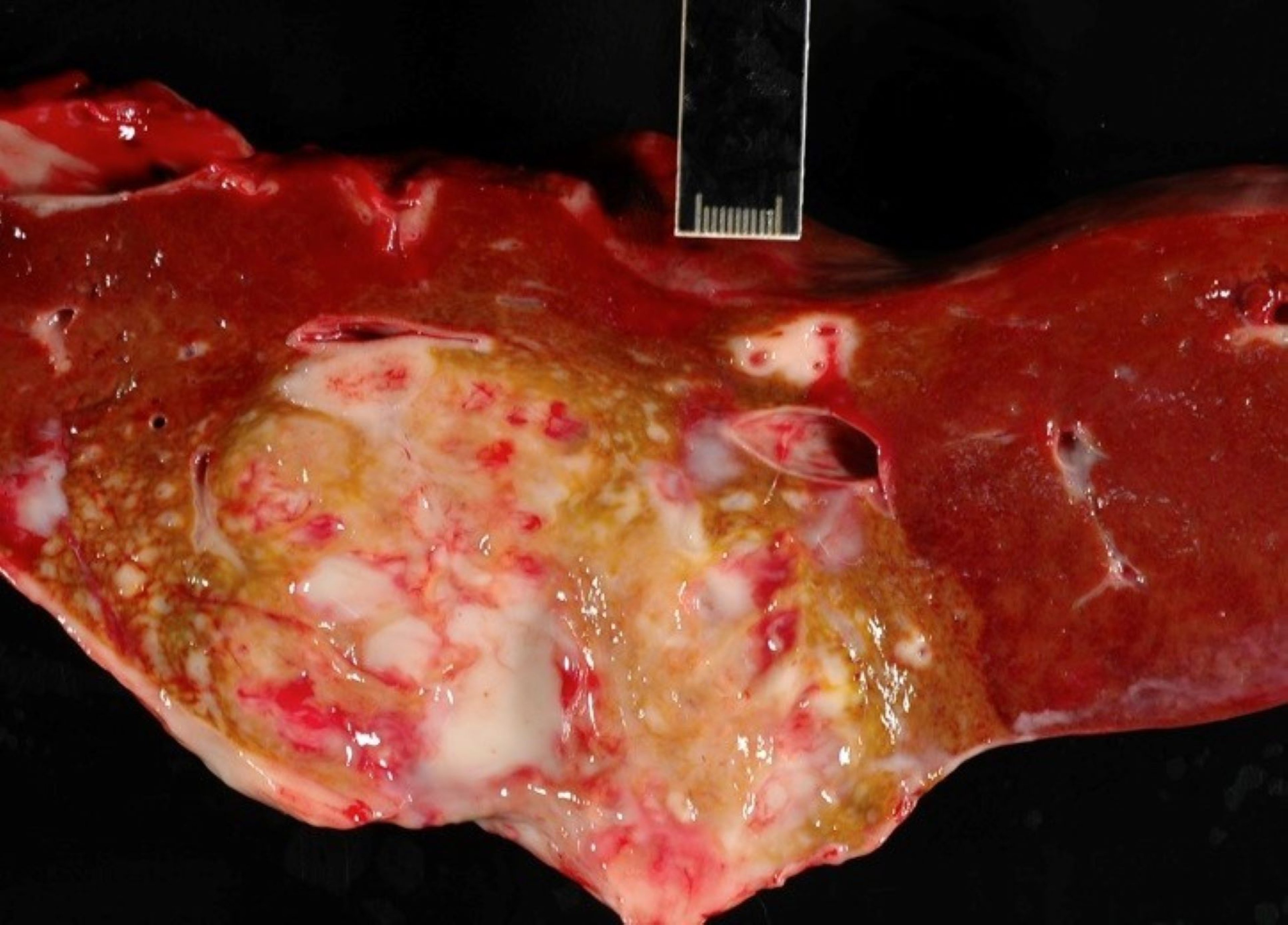 Lymphangitis, liver abscess, necropsy specimen, horse