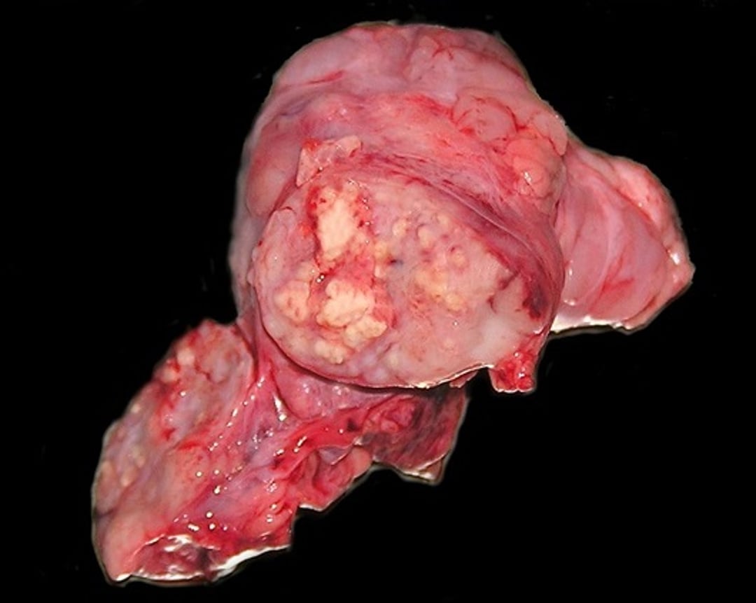 <i >Mycobacterium bovis</i> lesions, wild boar