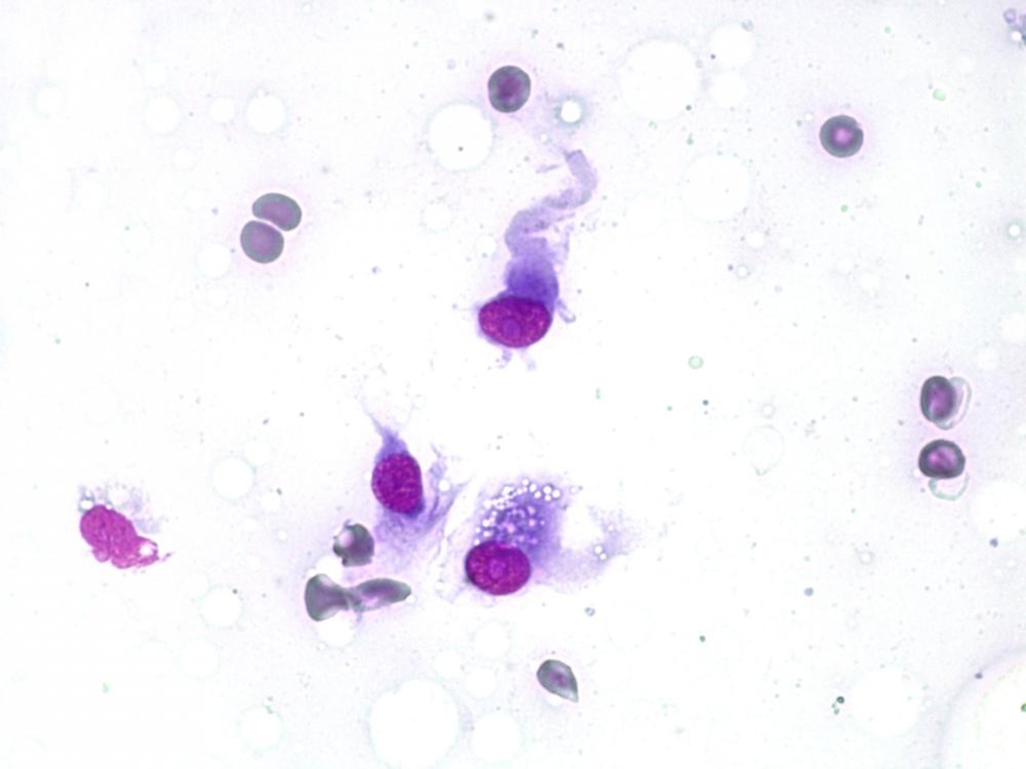 Mesenchymal, or spindle, cells