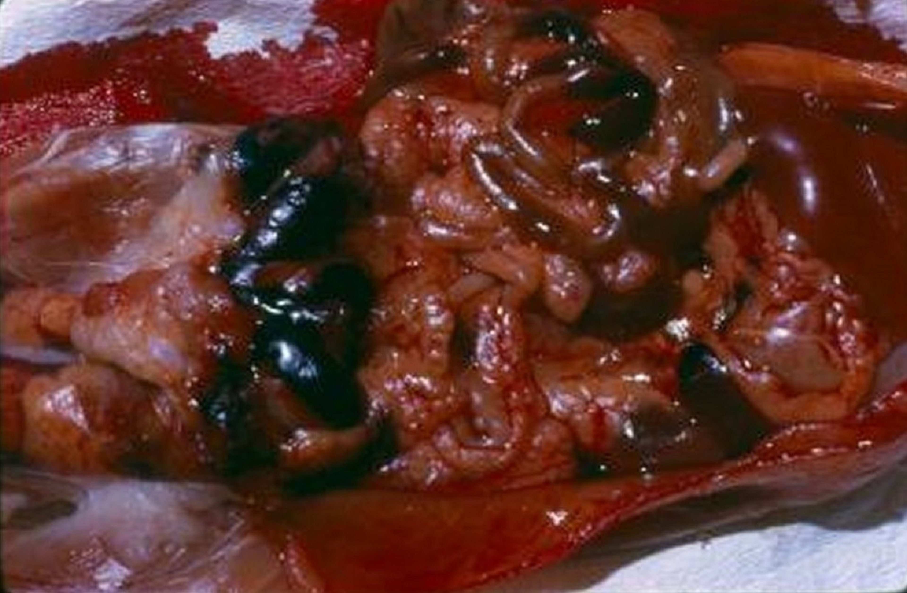 Mesenteric hemorrhage, anticoagulant rodenticide poisoning