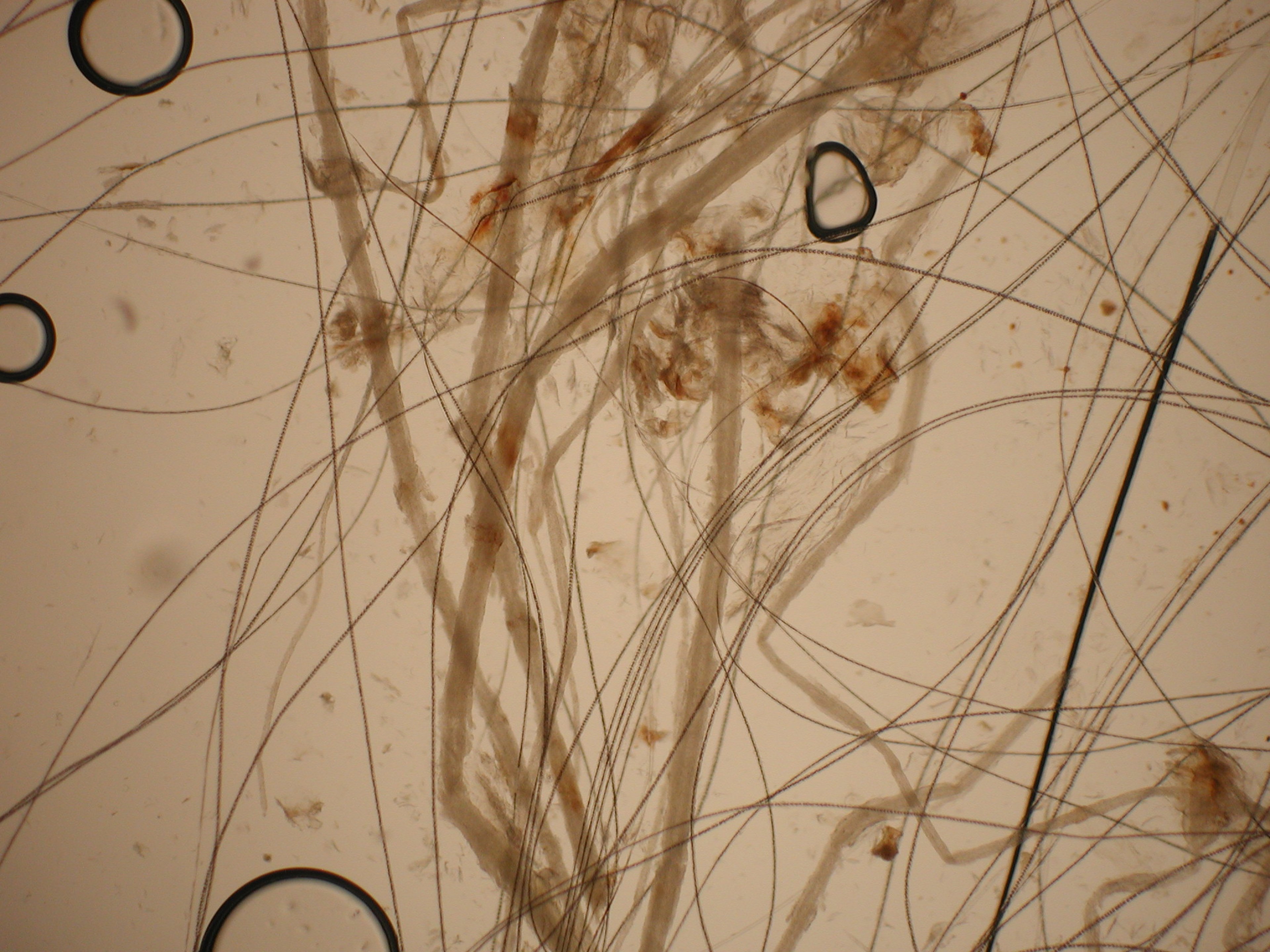 Direct examination of <i >M canis</i>-infected hairs