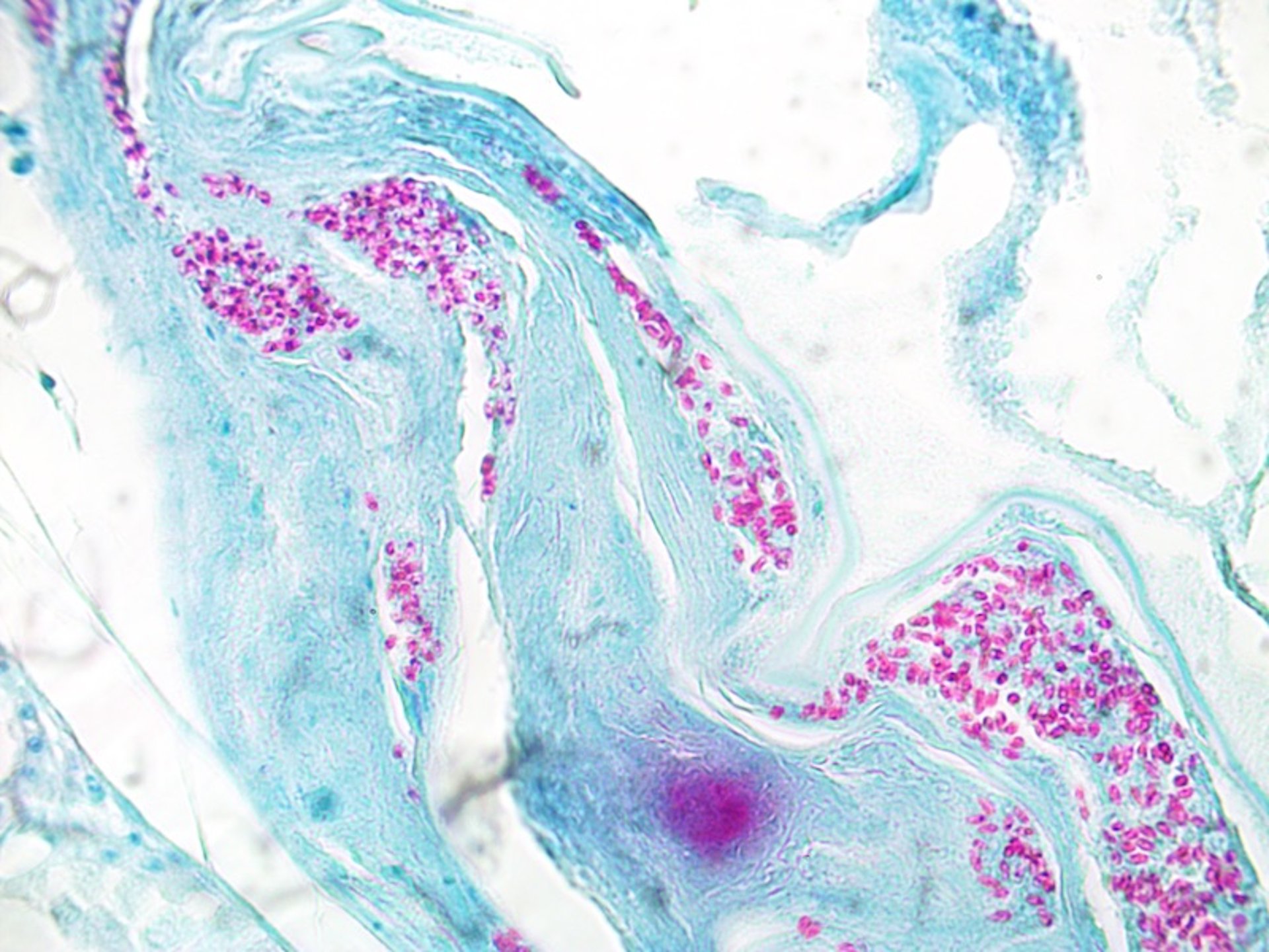 Microsporidia, acid-fast stain, anterior kidney, largemouth bass