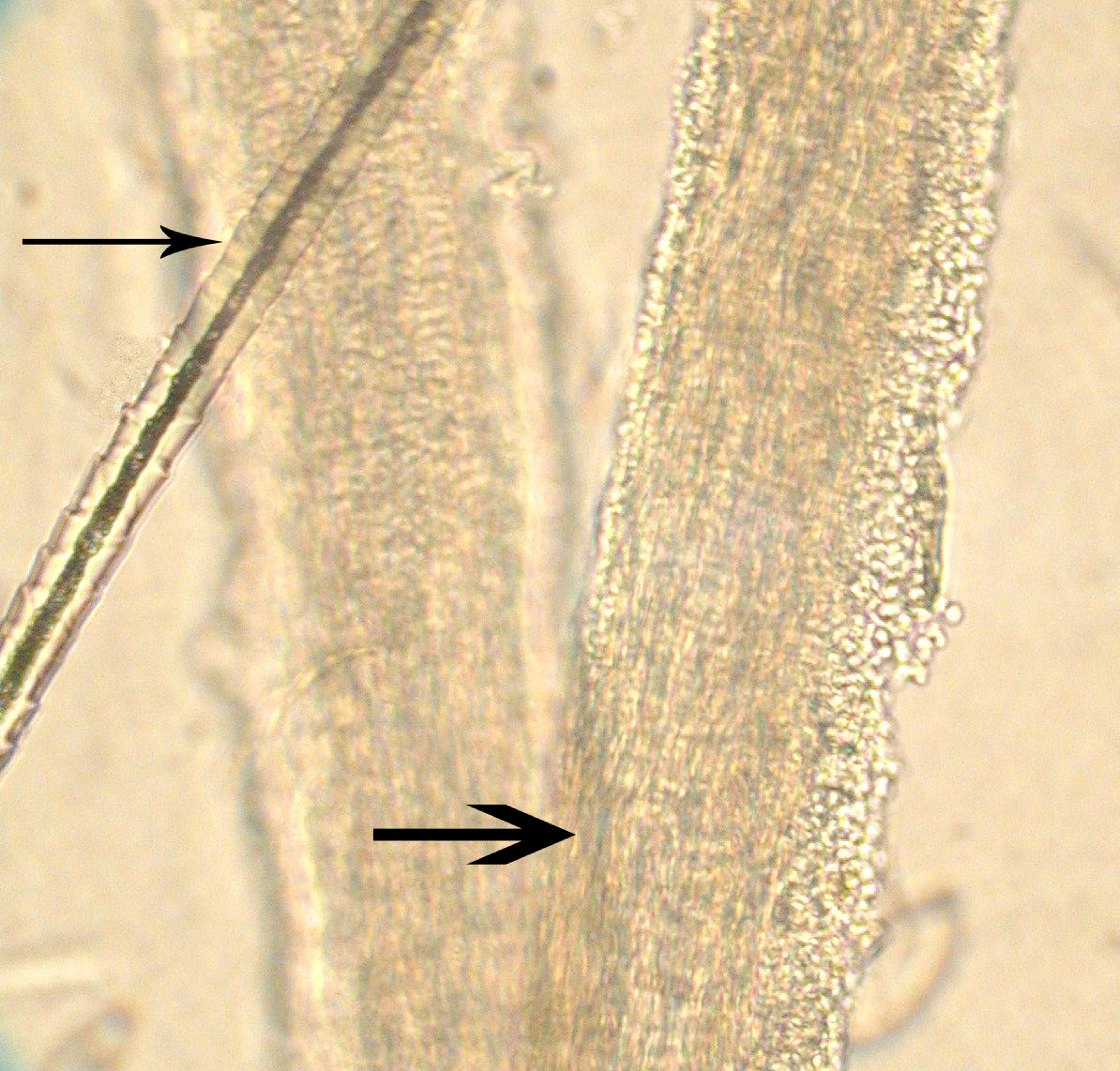 Normal hair and an <i >M canis</i>-infected hair