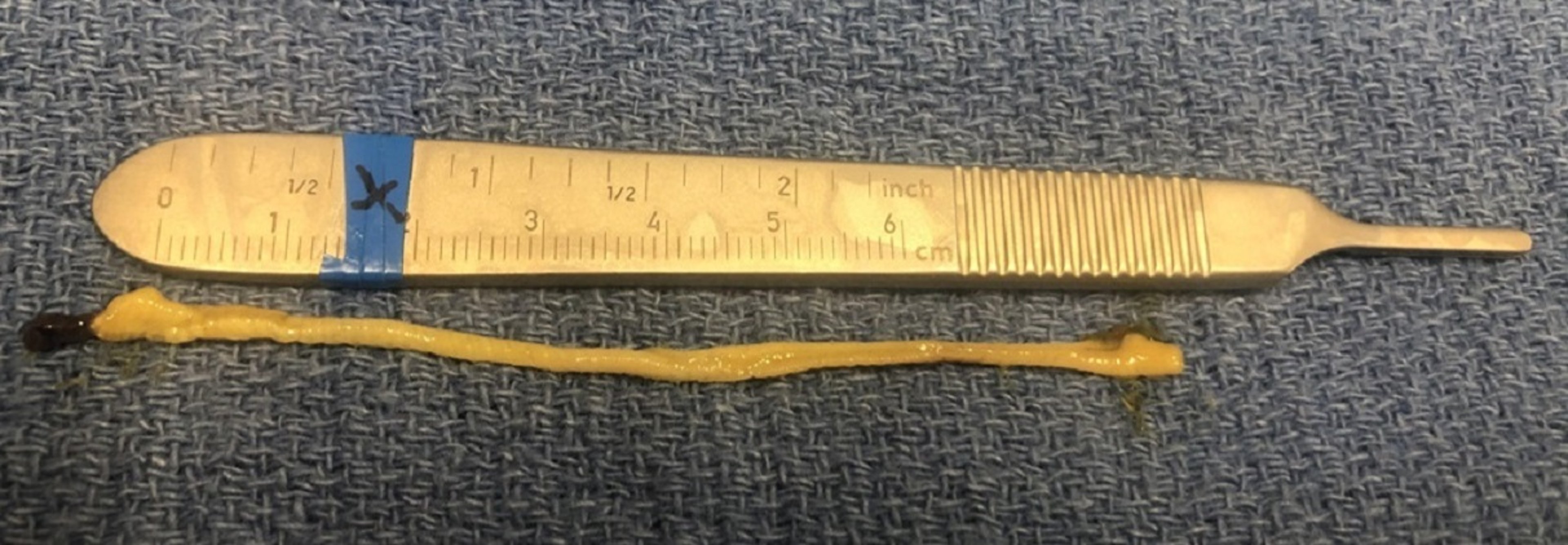 <i >Moniezia</i> tapeworm passed in goat feces