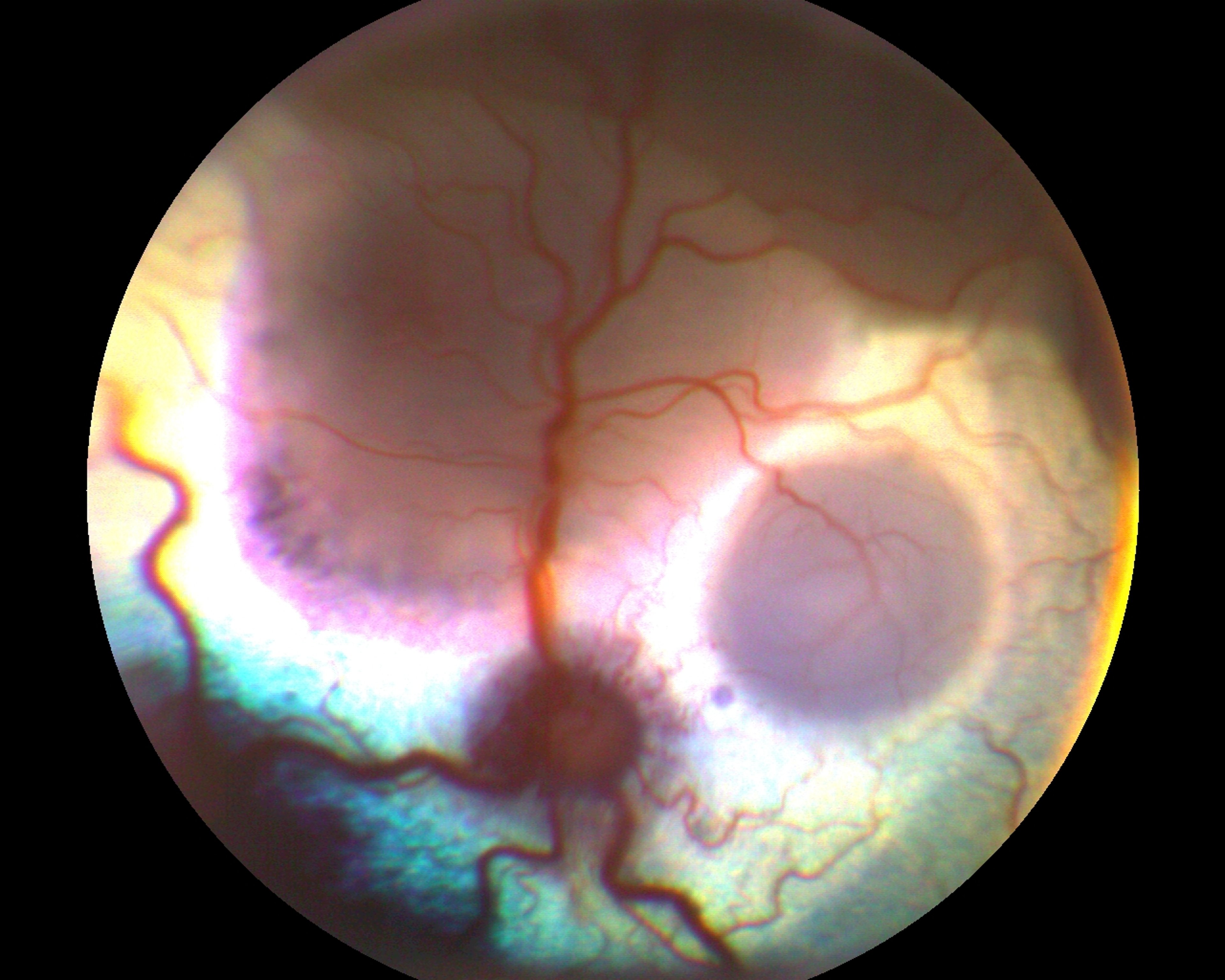 Multifocal retinal detachments, cat