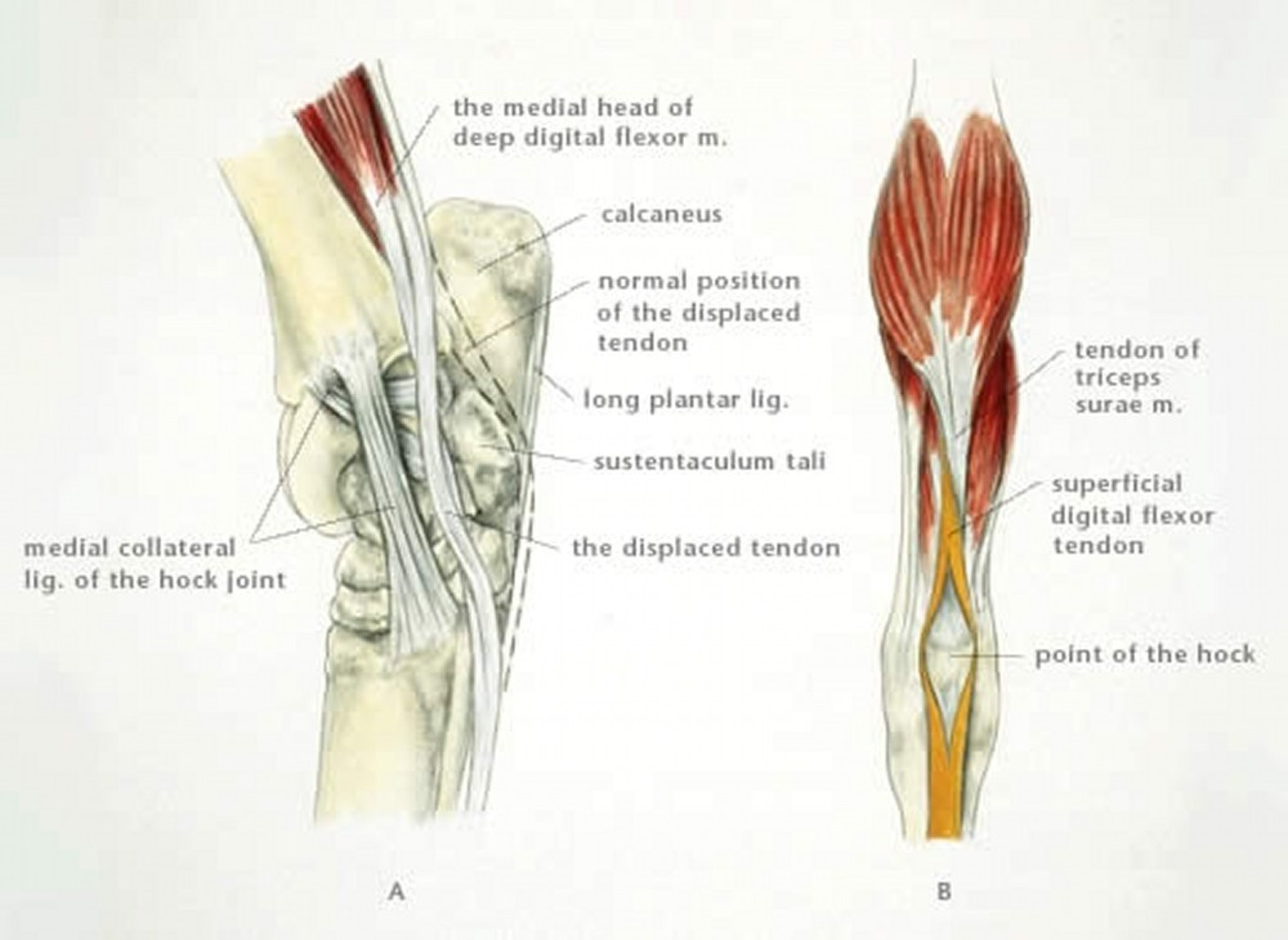 Displacement of deep digital flexor tendon, rupture of superficial digital flexor tendon, horse