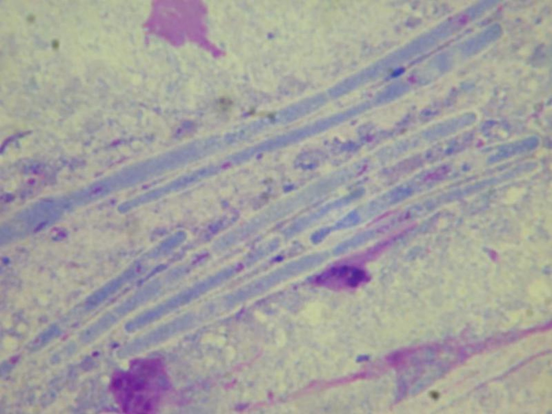 <i >Macrorhabdus</i>, diamante-de-Gould