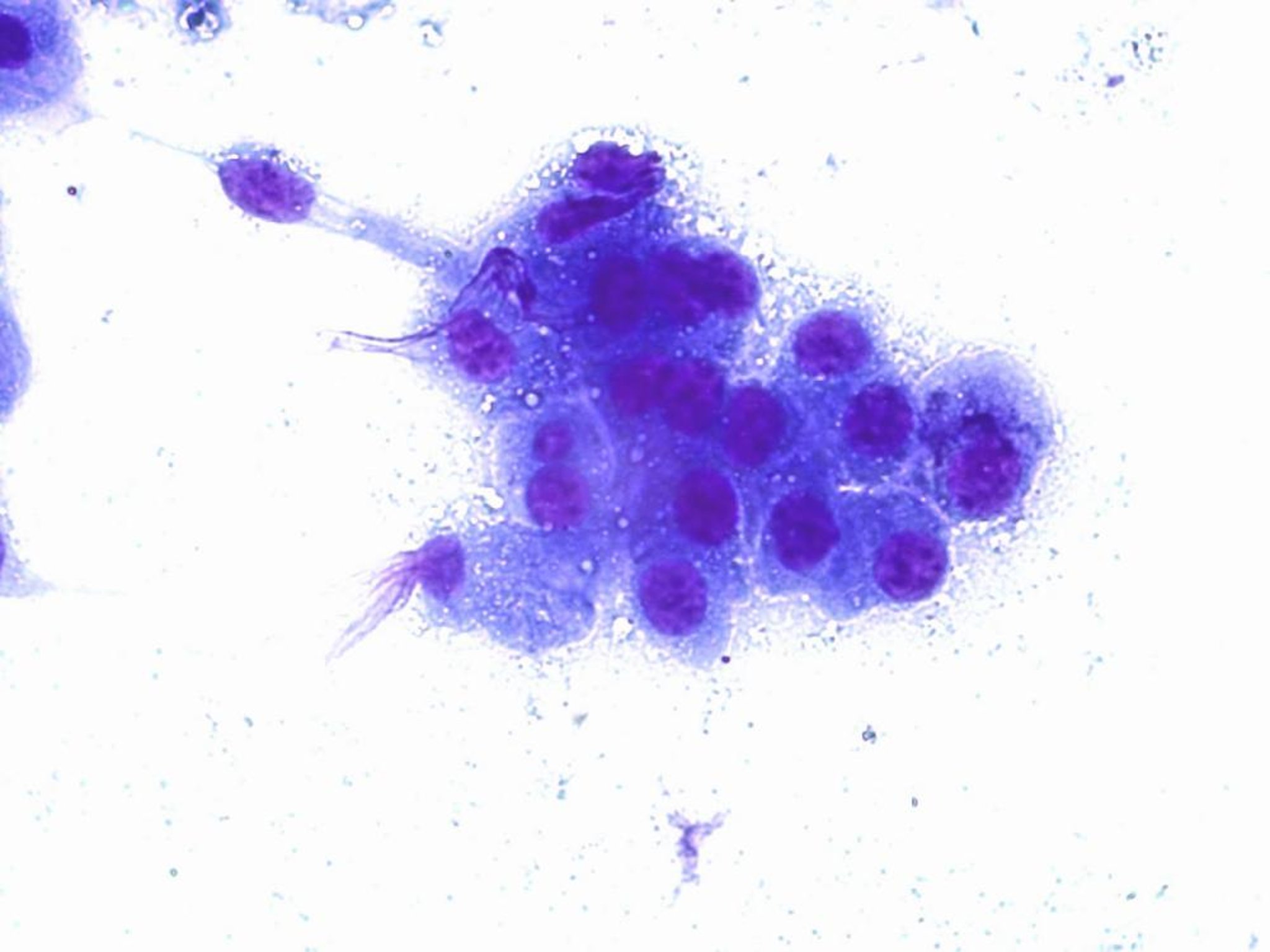 Carcinoma mamario, perro