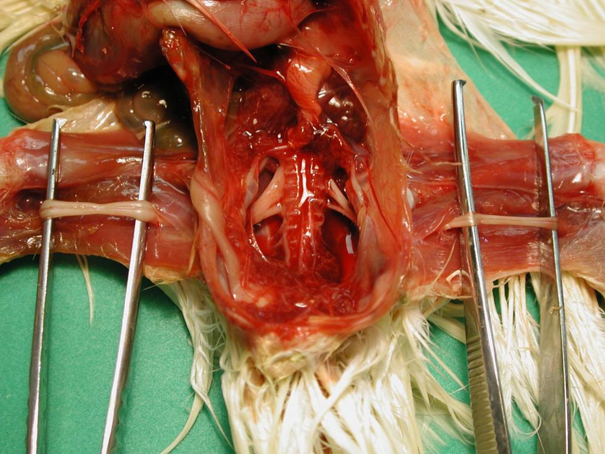 Marek's disease, peripheral nerve enlargement, chicken