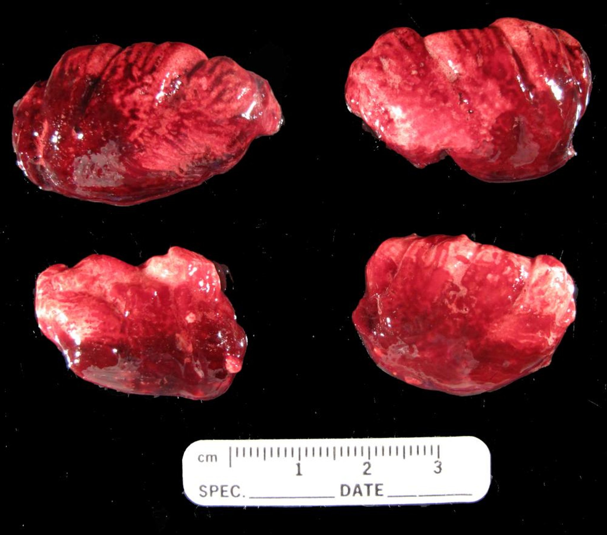 Massive pulmonary edema and hemorrhage, PTFE poisoning, pheasants
