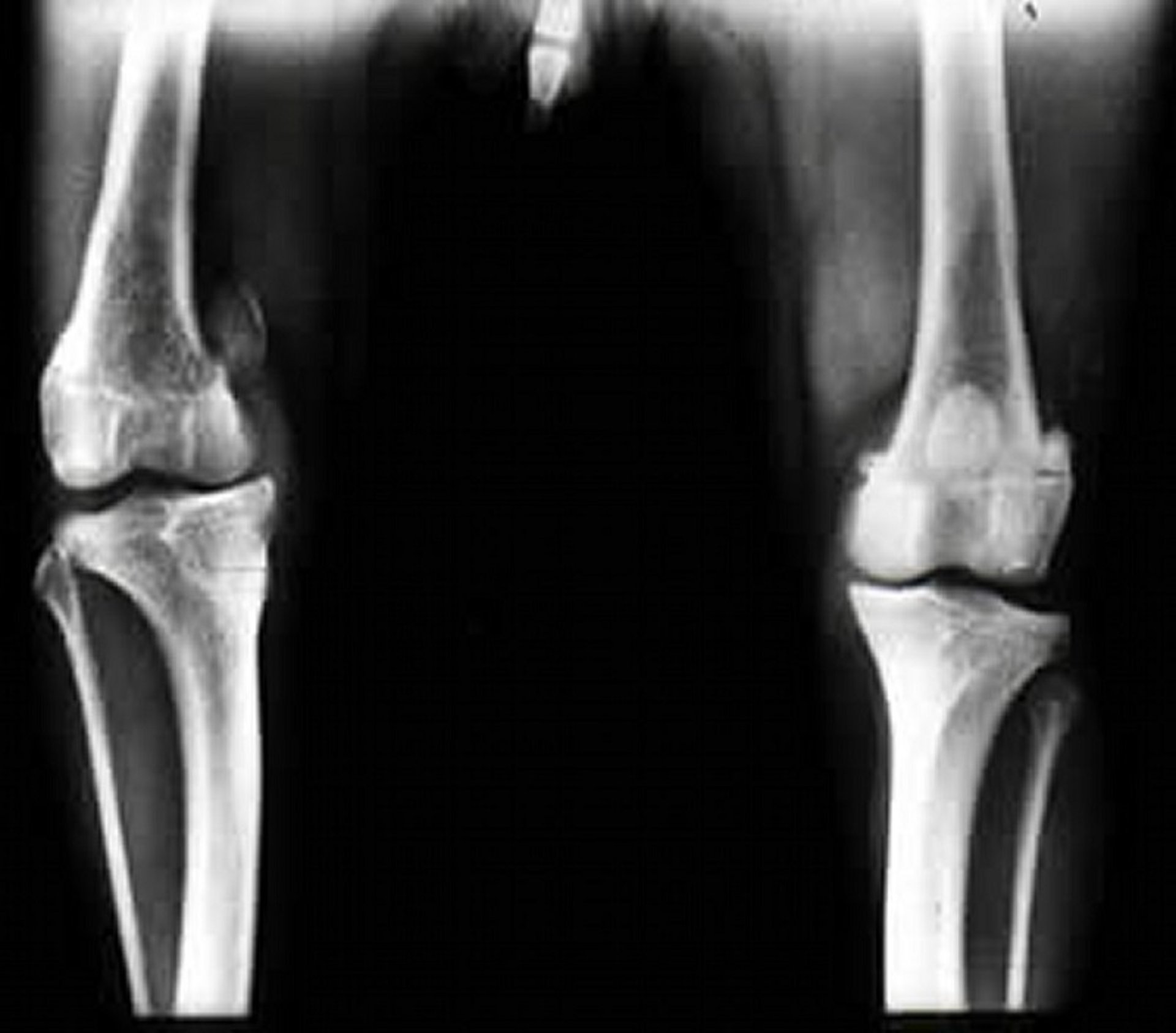 Medial patellar luxation, radiograph, dog