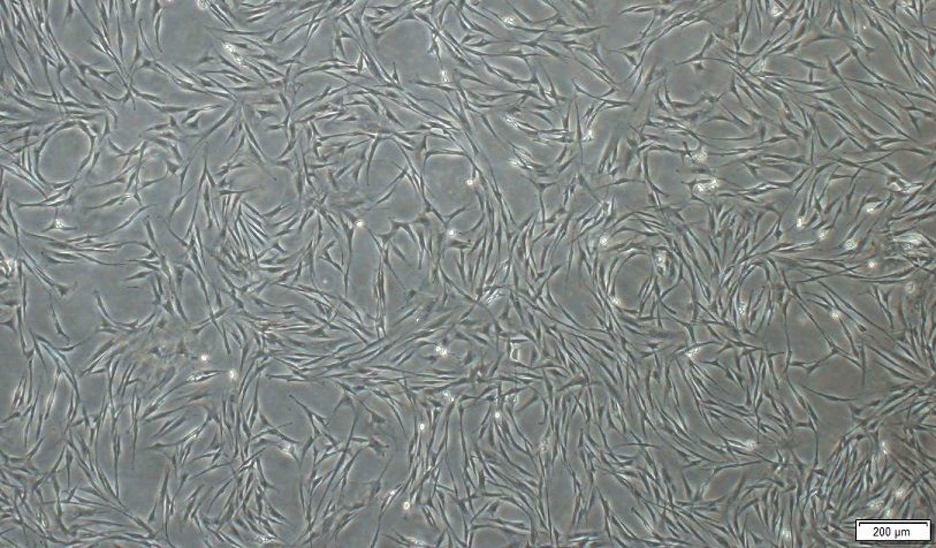 Mesenchymal stem cells, horse