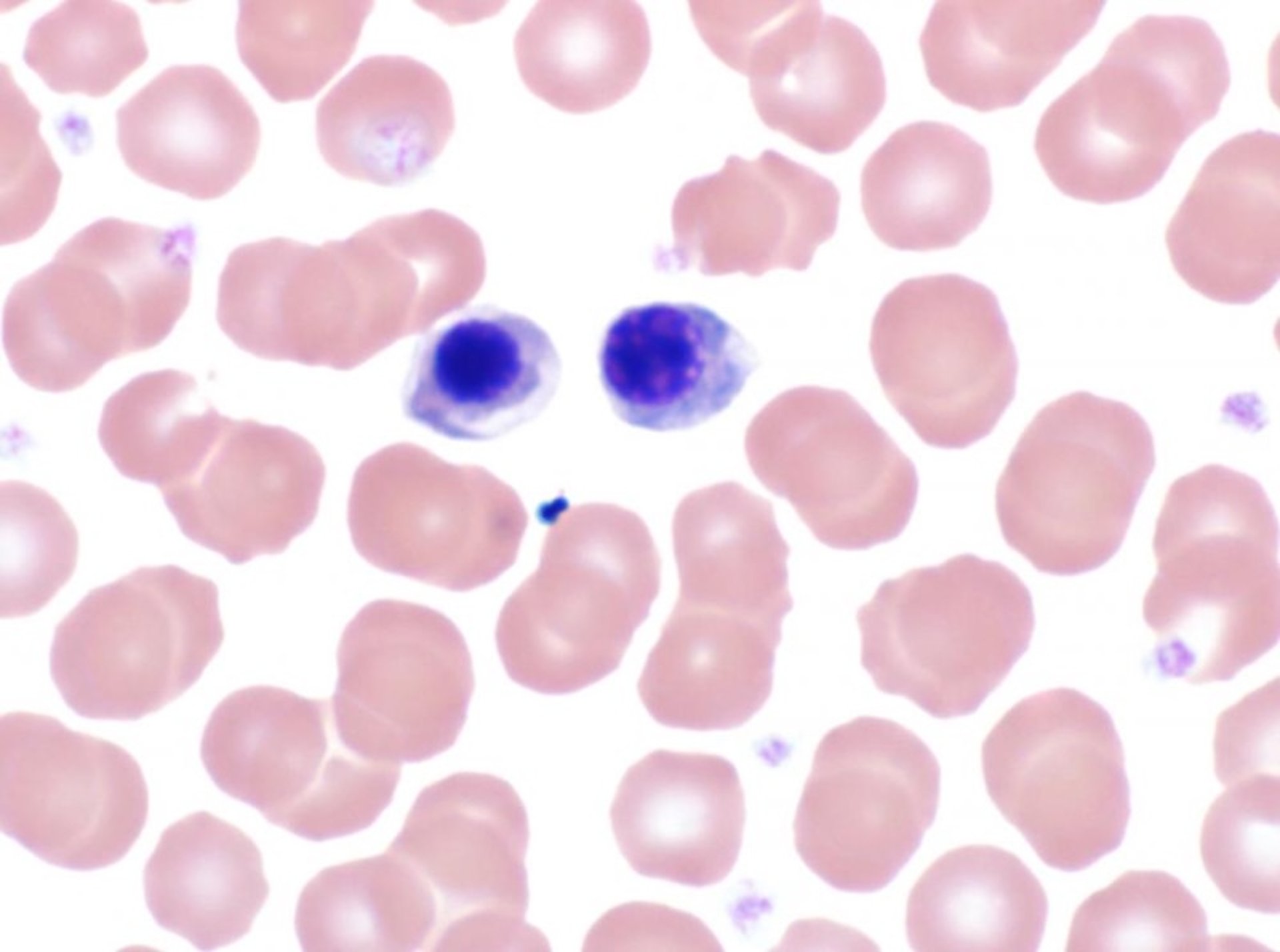 Metarubricytes, blood smear, dog
