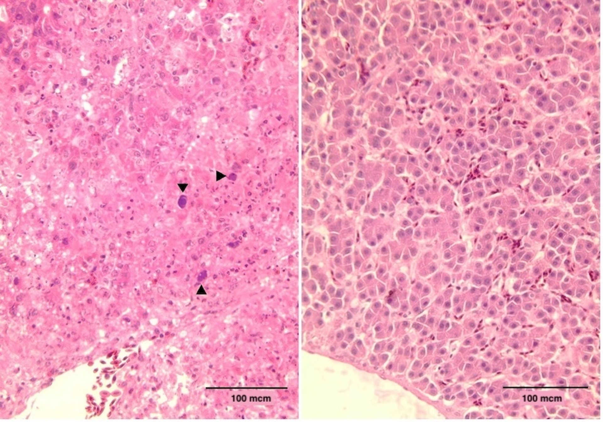 Lesiones hepáticas microscópicas, hepatitis por cuerpos de inclusión, aves de producción