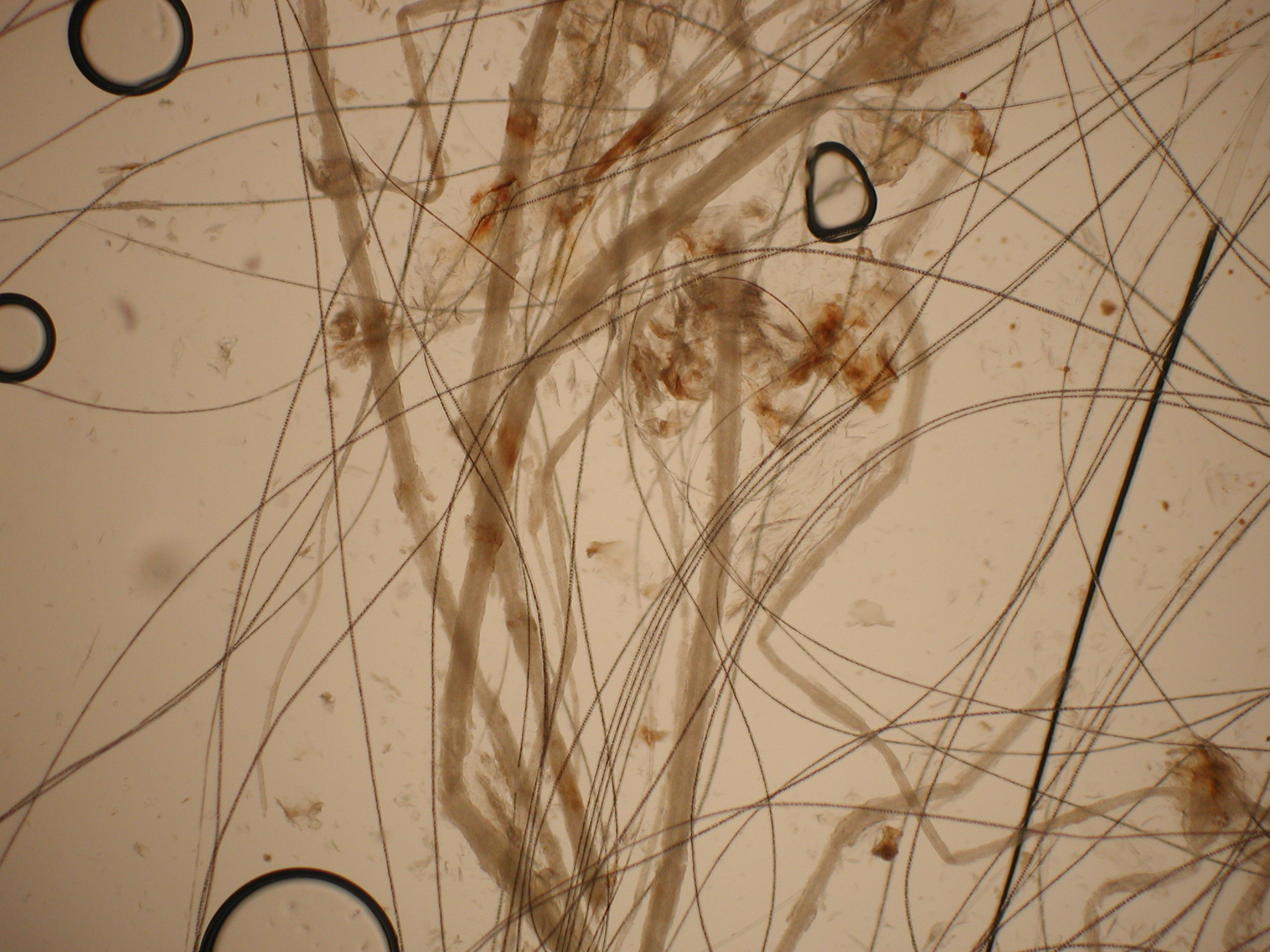 Examen directo de pelos infectados por <i >M canis</i>