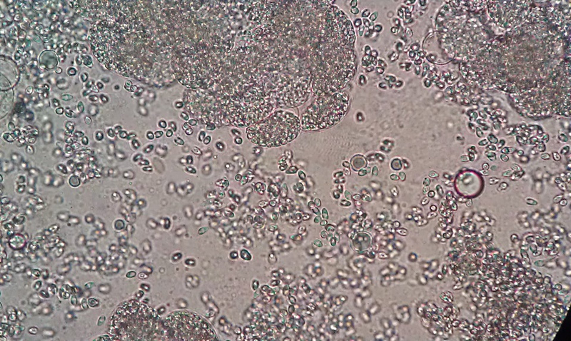 Preparación en fresco de microsporidios, pez cebra