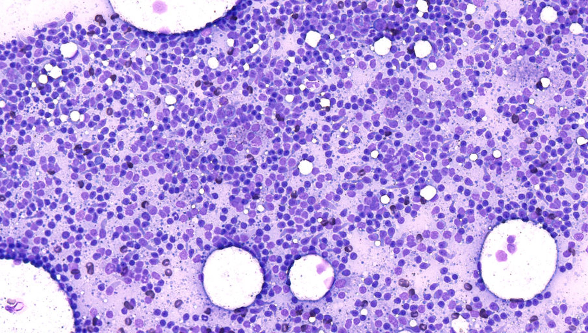 Monolayer of cytologic smear, lymphocytes