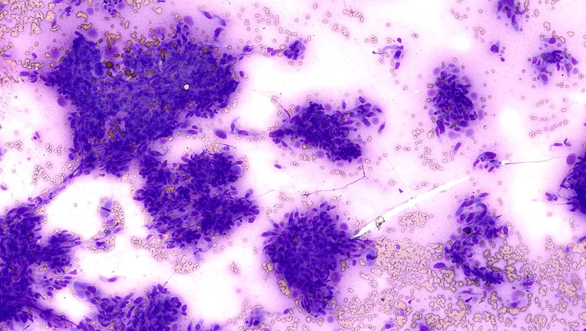 Monolayer of cytologic smear, mesenchymal cells