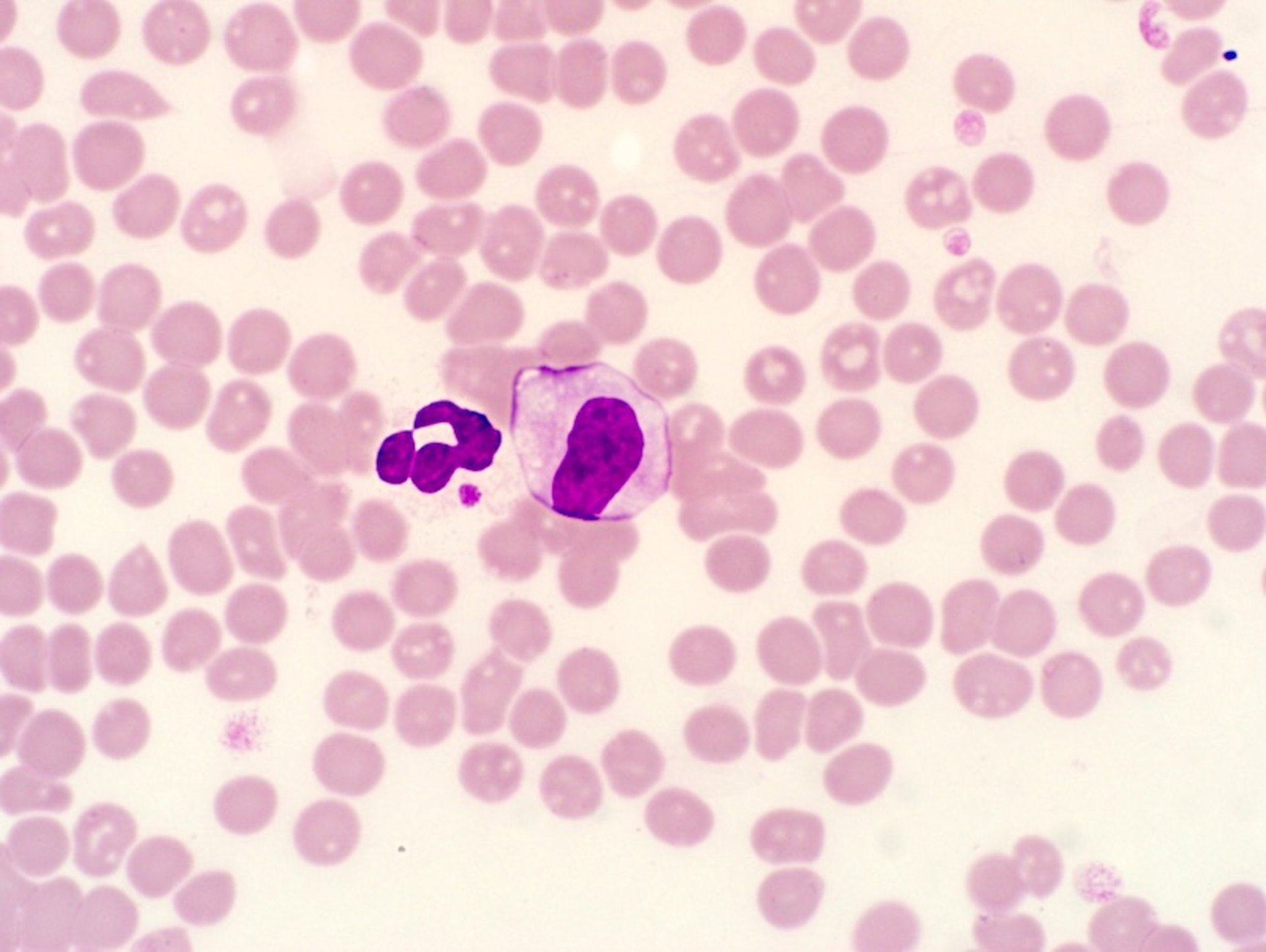 Morula, blood smear, dog