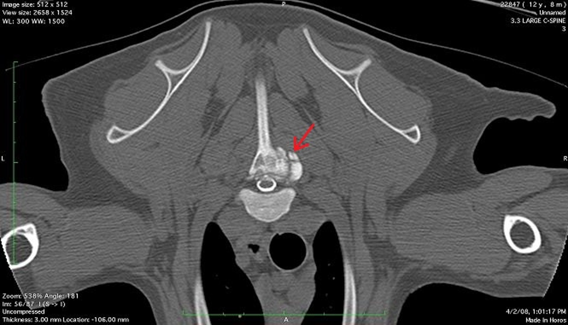 Multiple cartilaginous exostosis, dog, CT scan