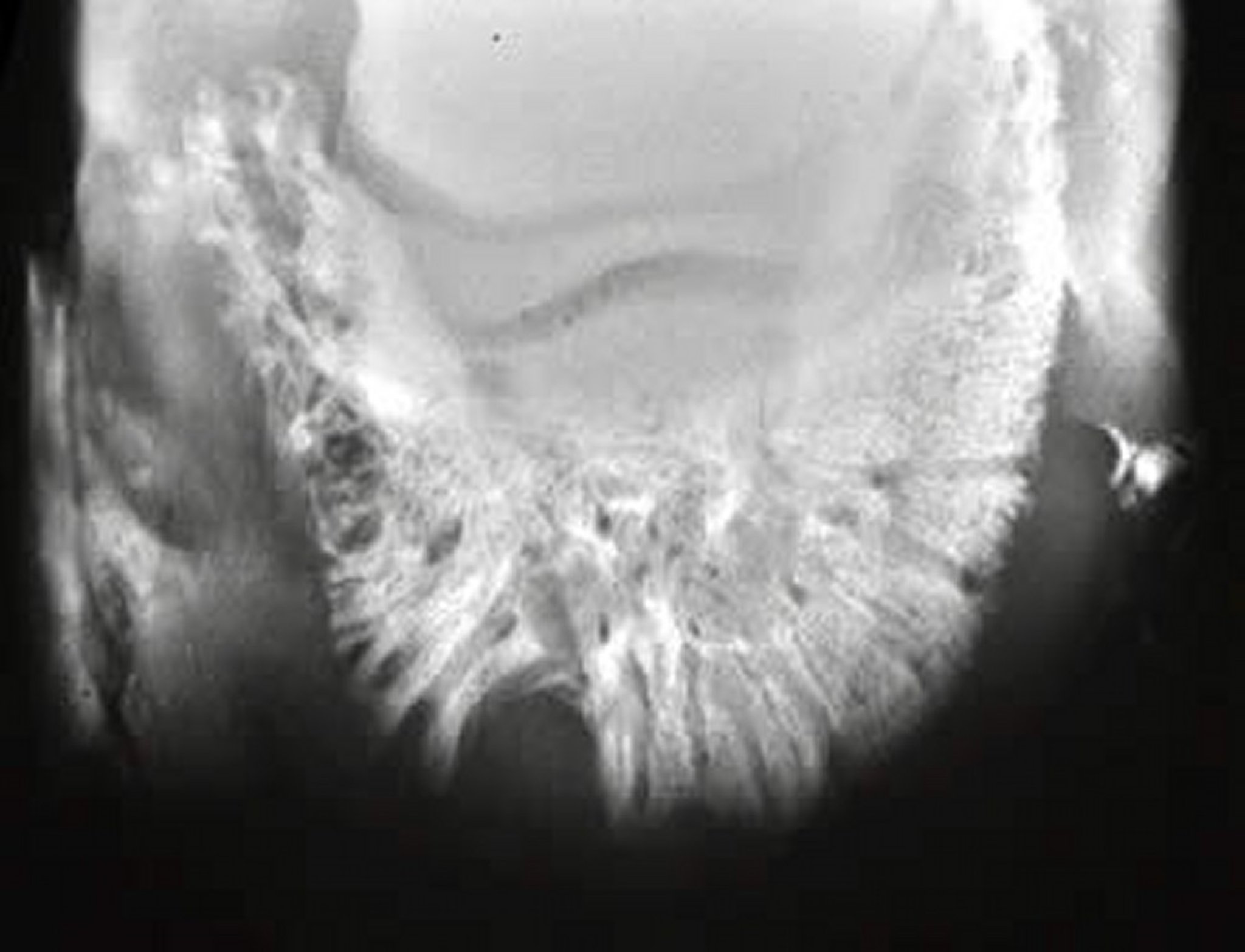 Absceso solar, radiografía, caballo