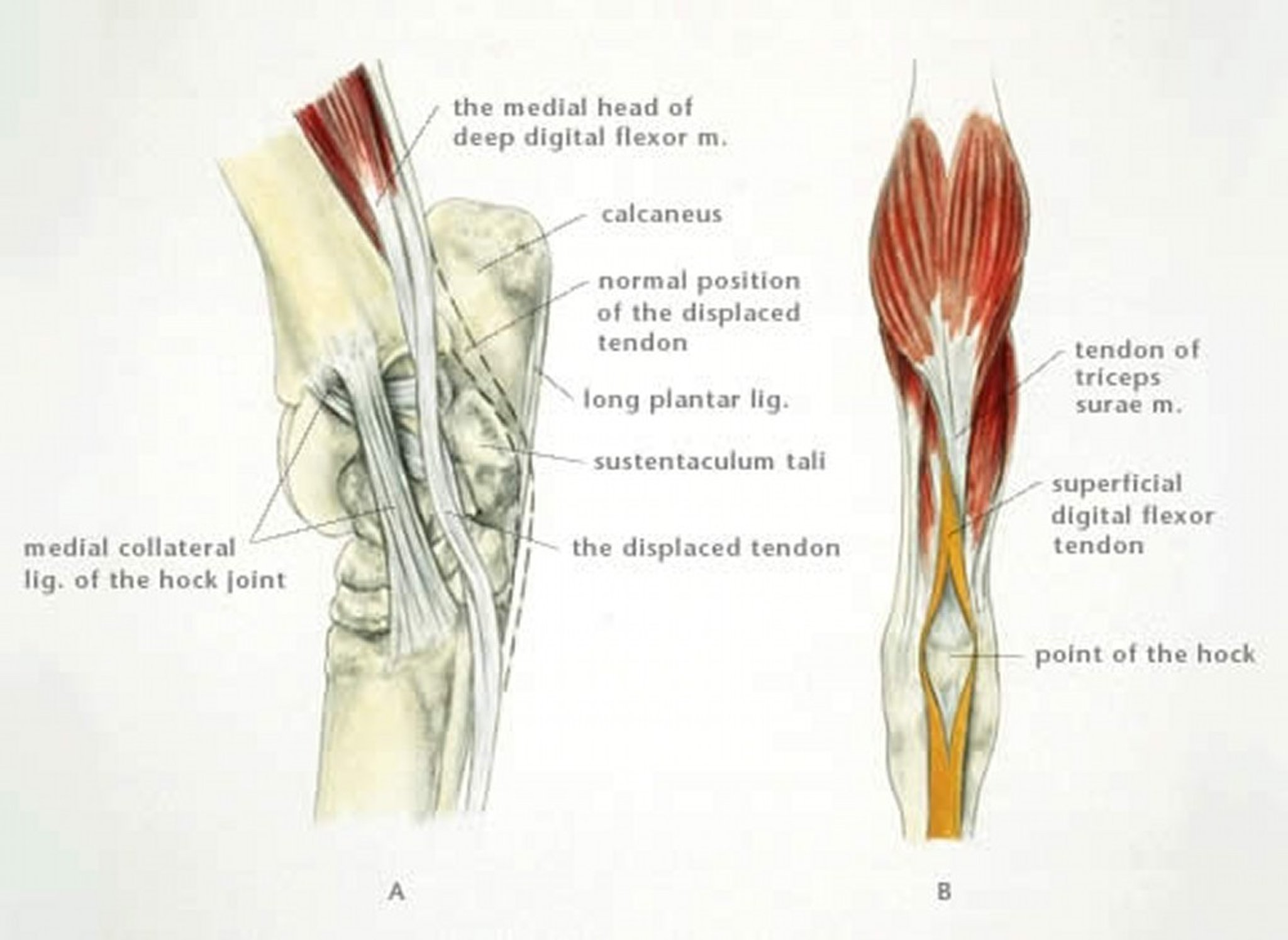 Desplazamiento del tendón flexor digital profundo, rotura del tendón flexor digital superficial, caballo