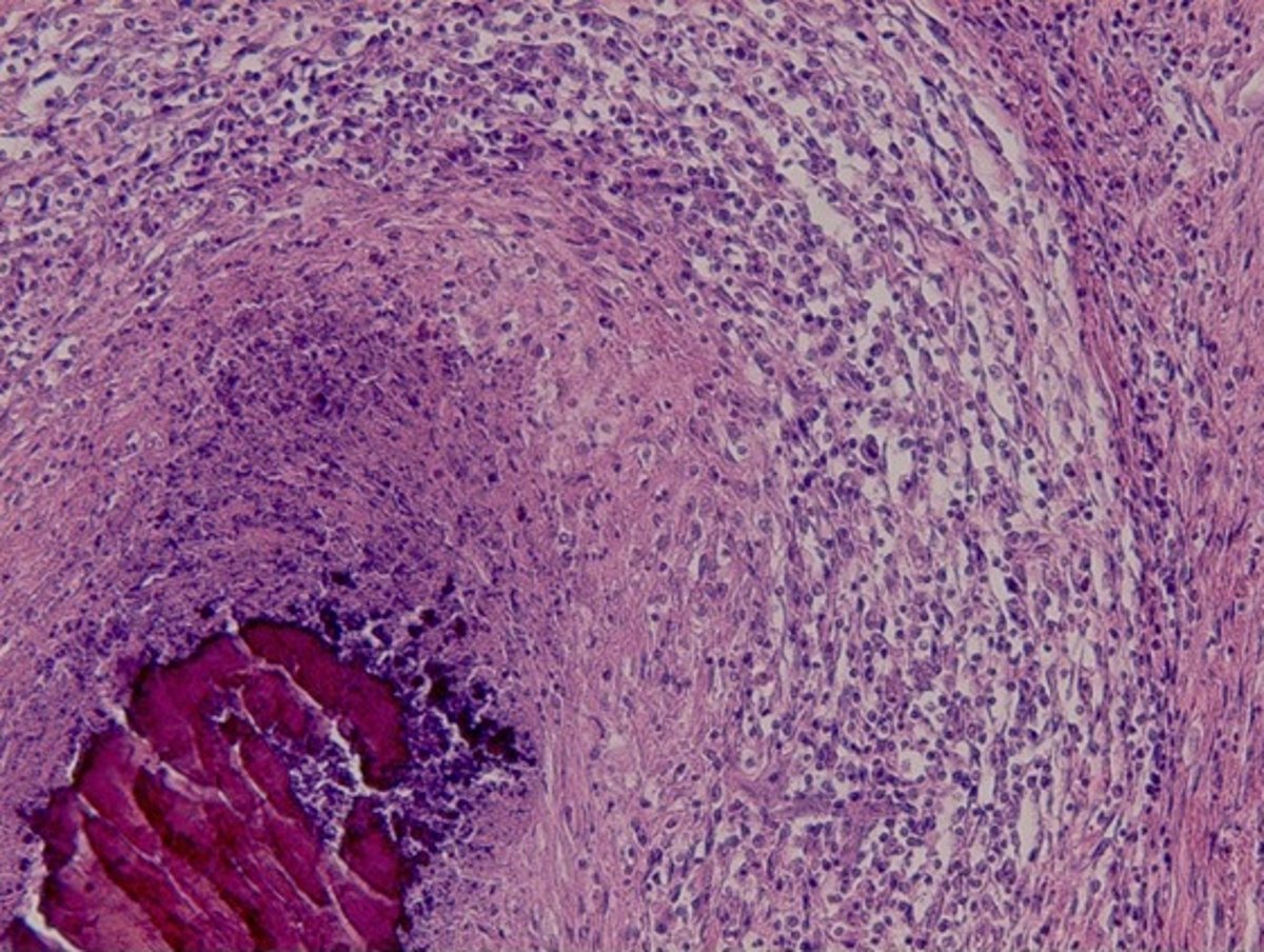Granuloma micobacteriano, jabalí silvestre