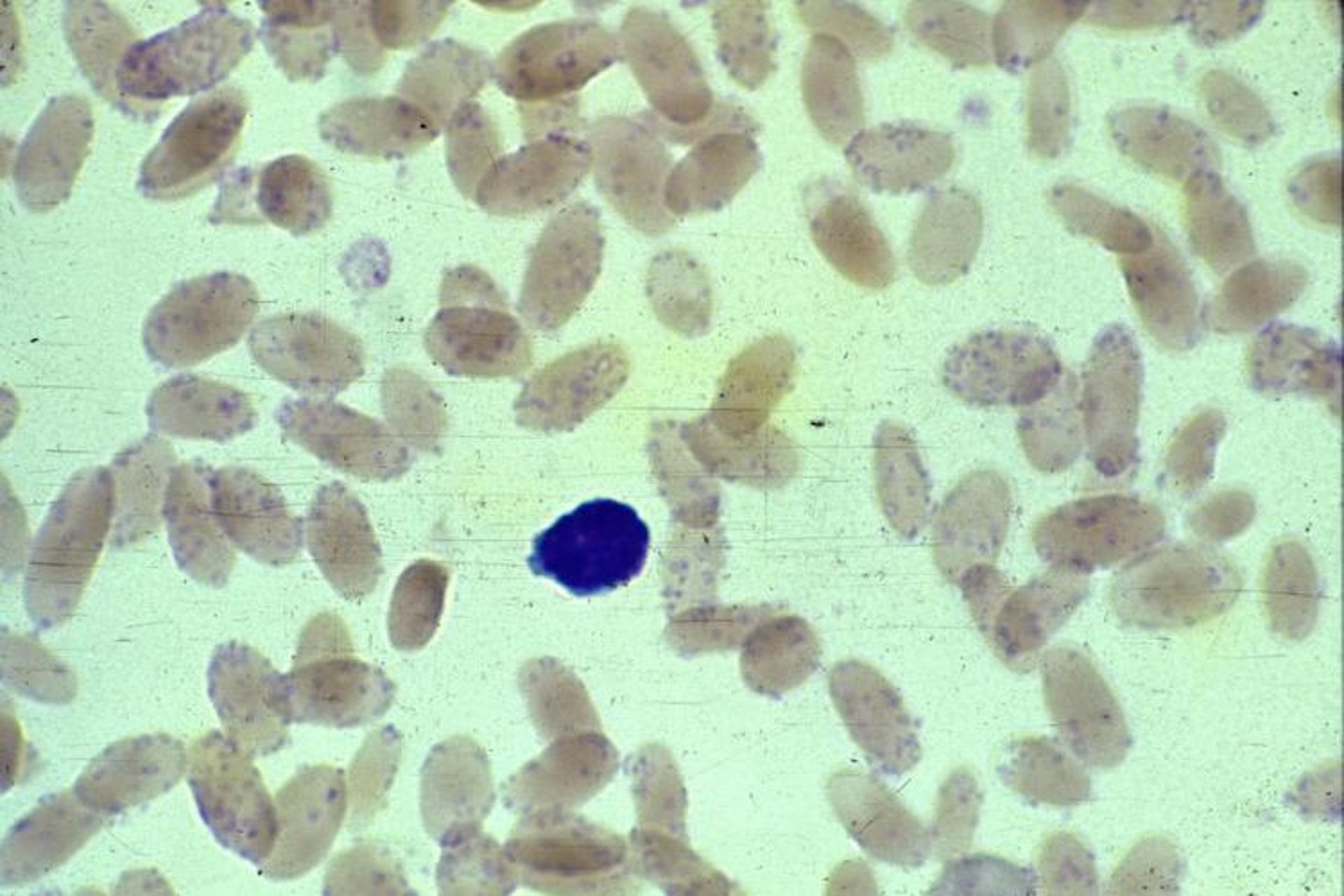 Infección por <i >Mycoplasma</i>, eritrocitos de llama