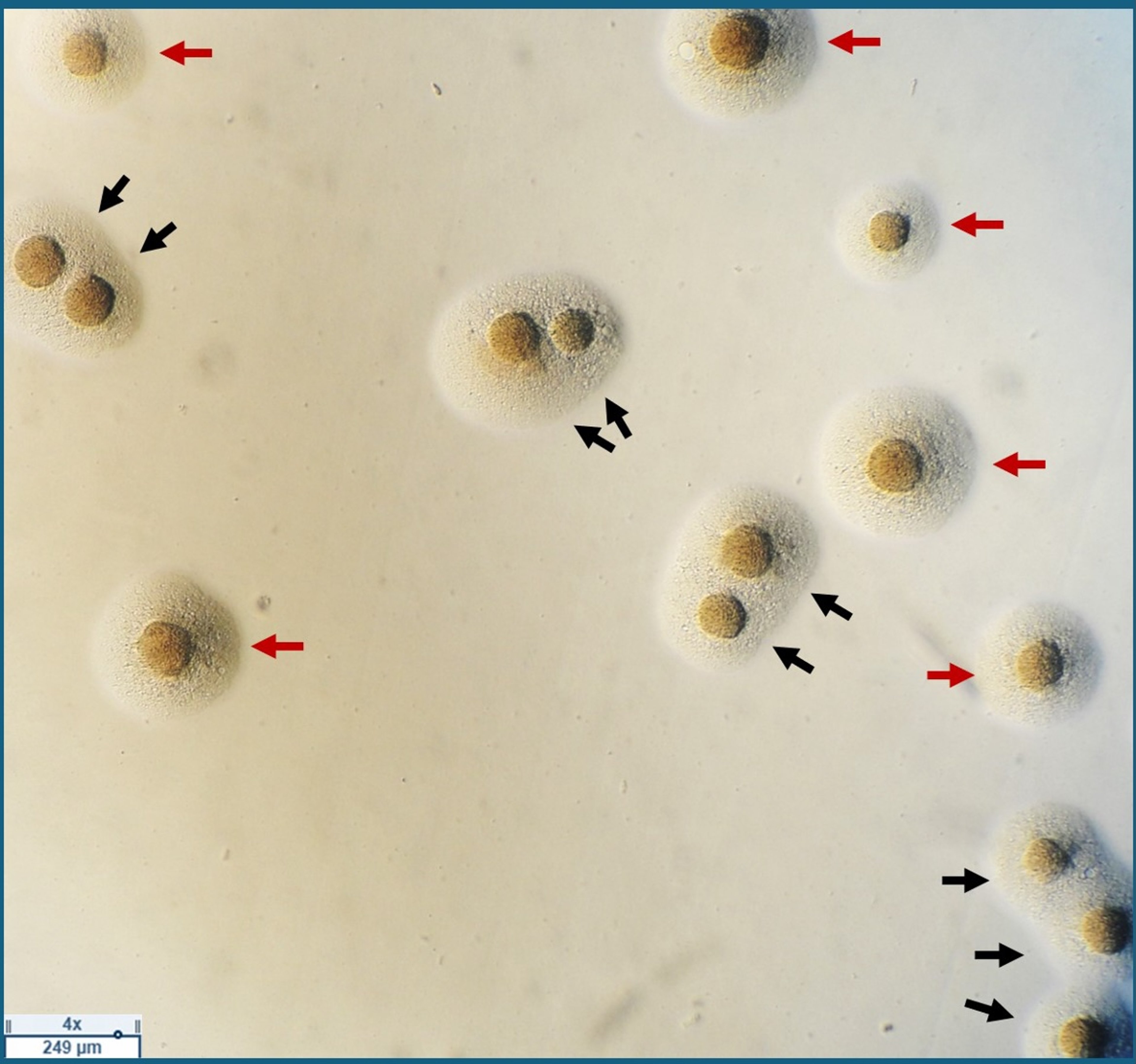 <i >Mycoplasma</i> colonies, photomicrograph