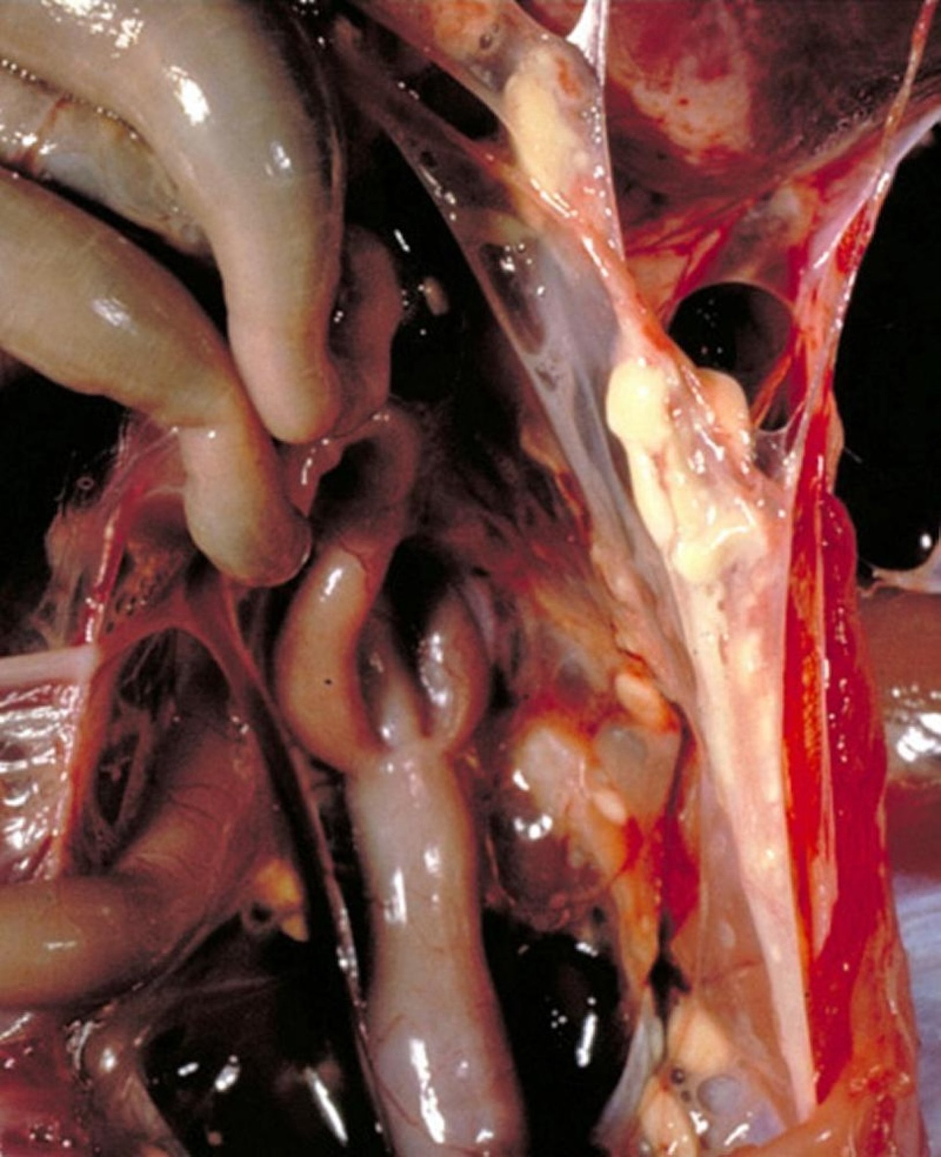<i >Mycoplasma meleagridis</i>, airsacculitis, turkey poult